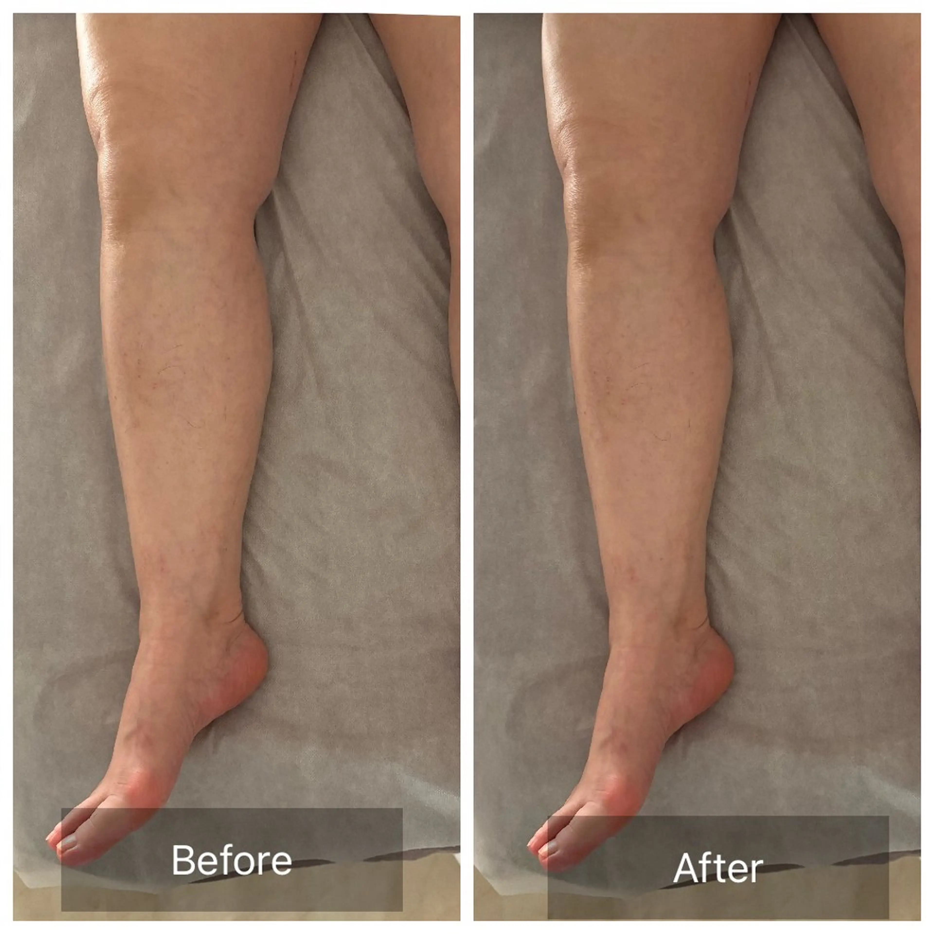 エステ Crystallo Sana N所属・痩身・リンパ 佐久間 自由が丘・奥沢のエステ・リラクイメージ