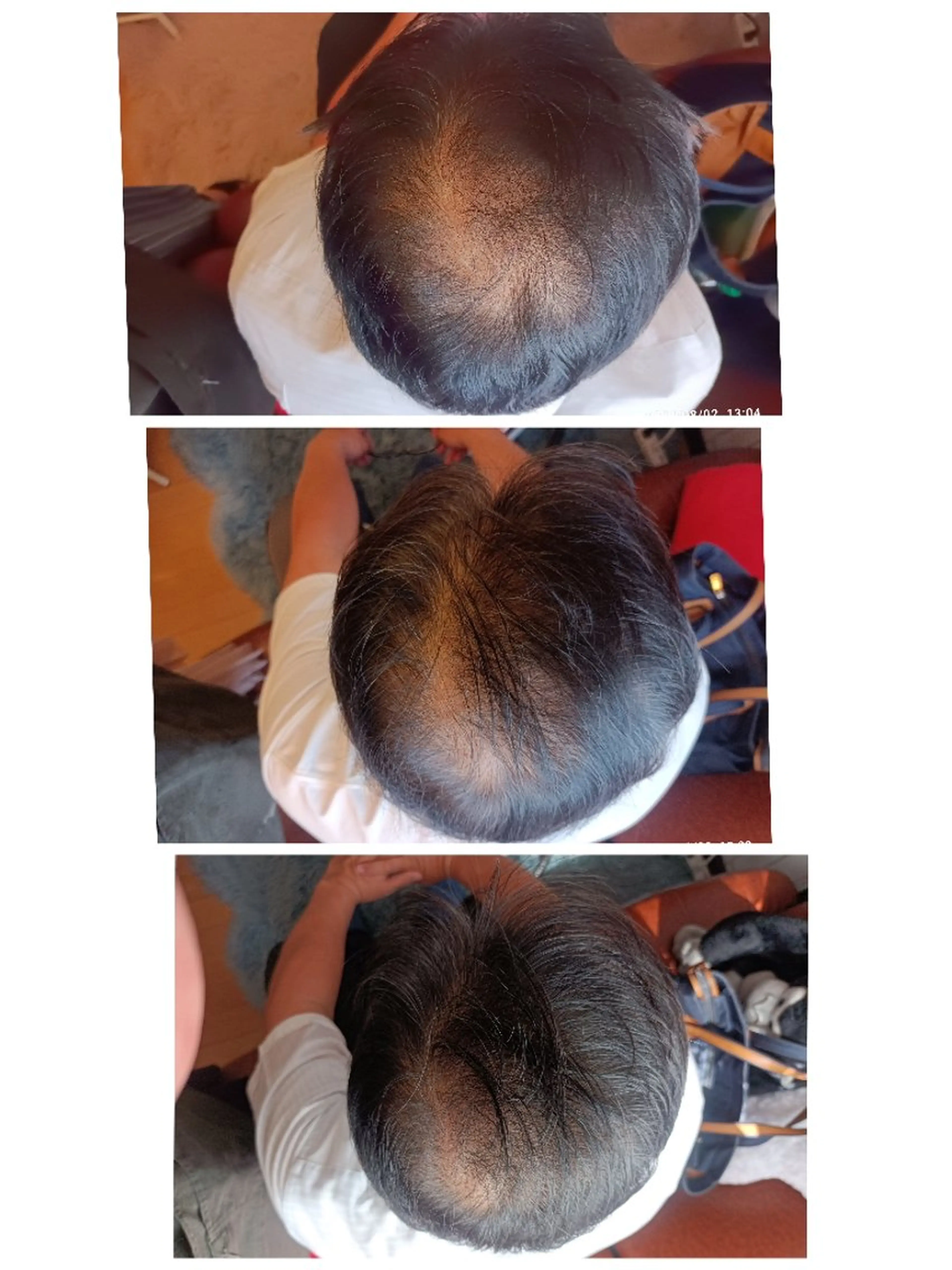 charmant (シャルマン)所属・エステサロン charmantのエステ・リラクイメージ