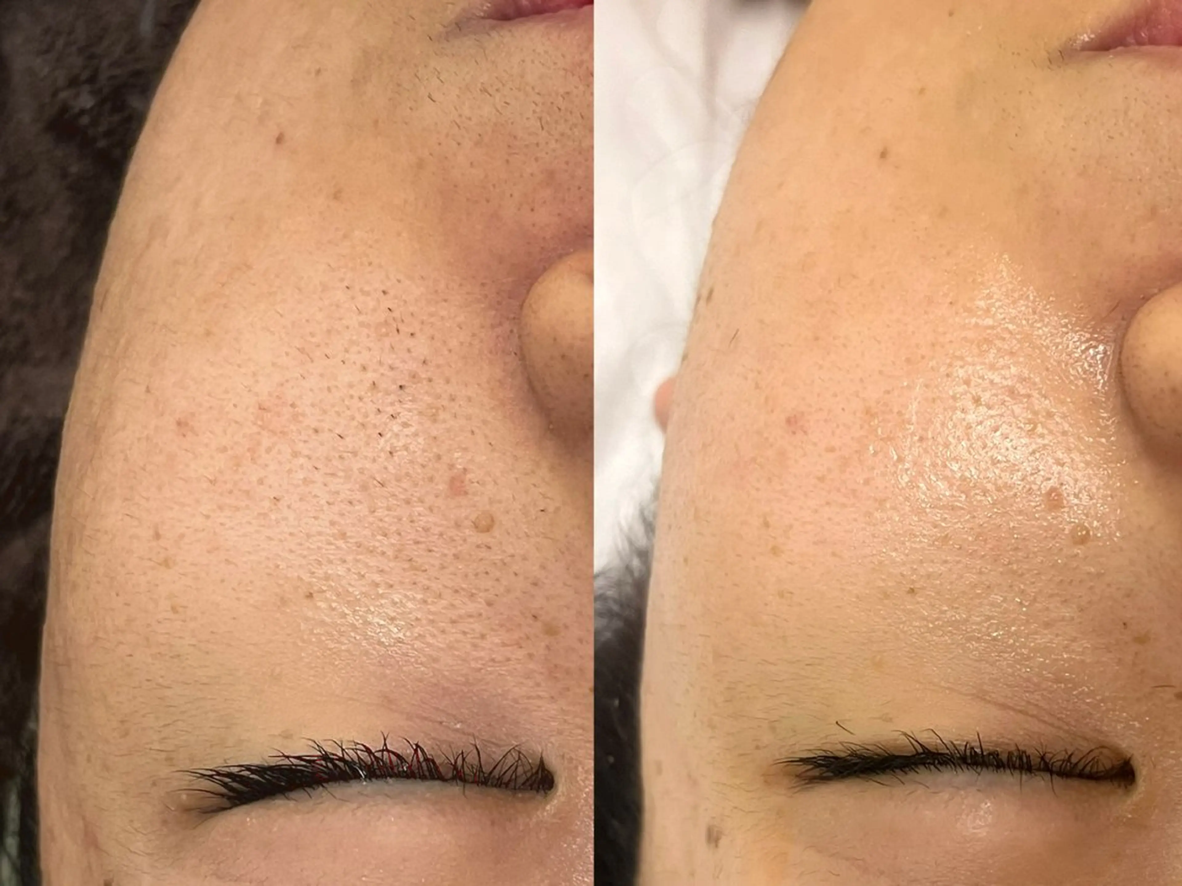 金の糸脱毛 産毛ケア専門のエステ・リラクイメージ