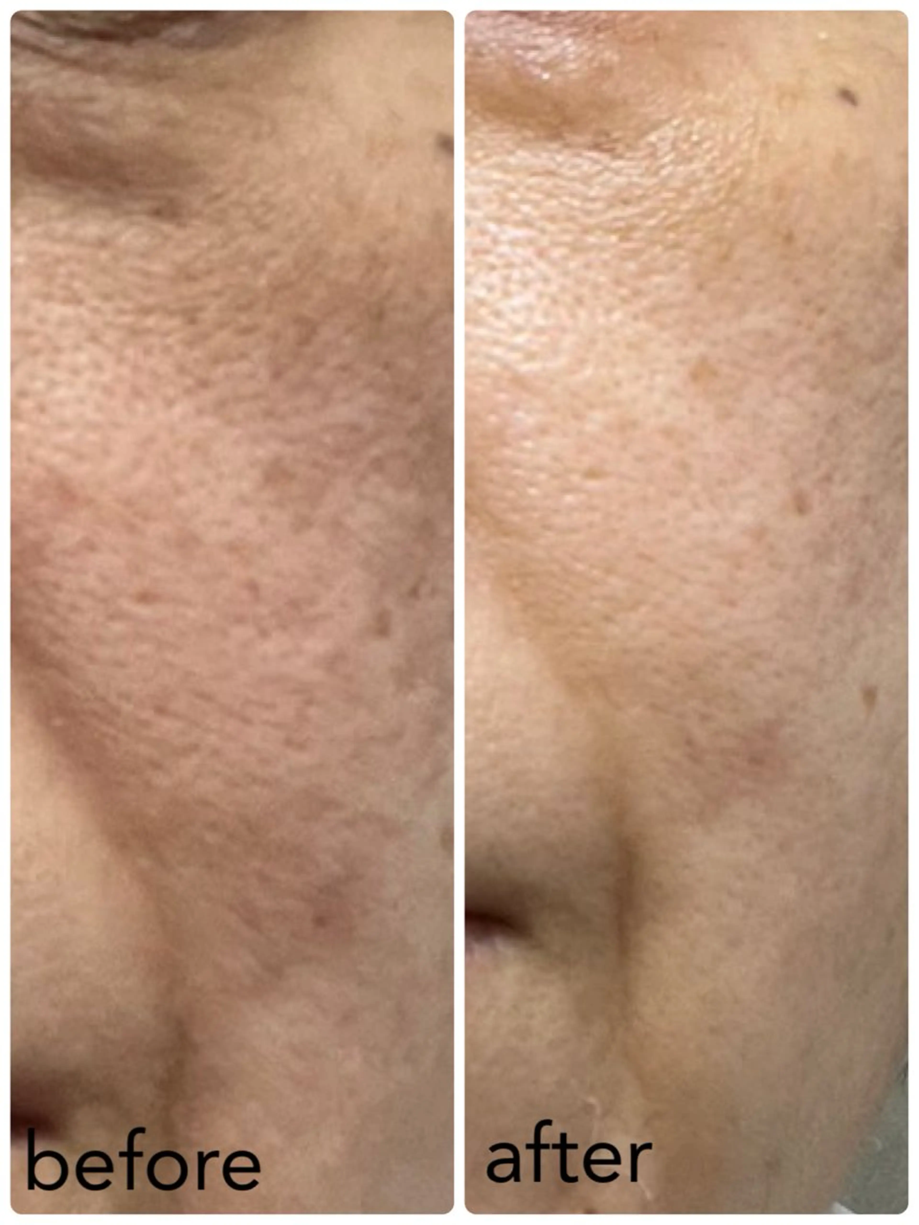 IVY化粧品・ 勝山亜優奈のその他イメージ