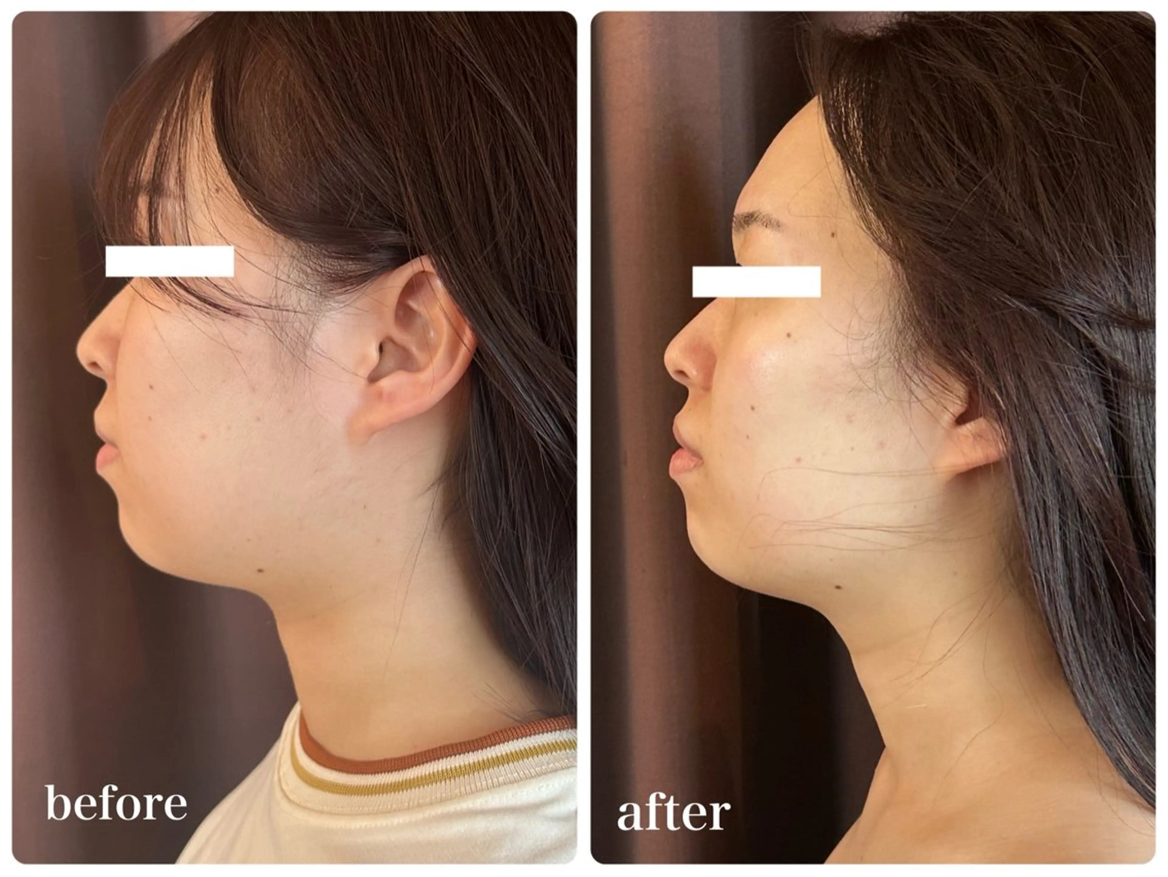 エステ ハイフ・小顔・骨盤 シャングリラのエステ・リラクイメージ