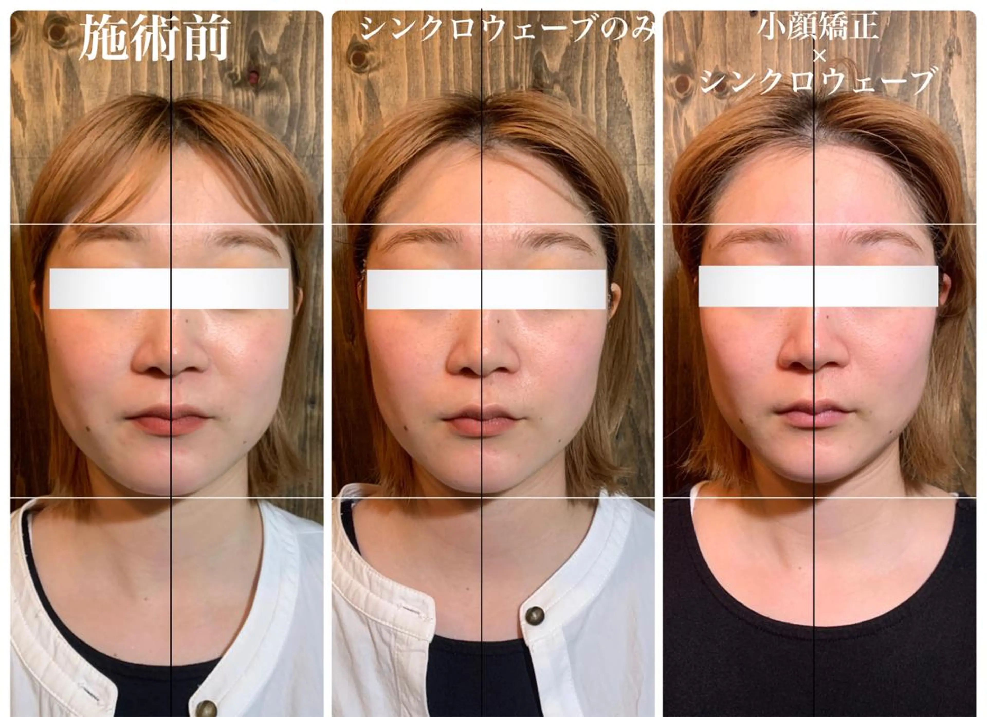 🌟人気No.1🌟破格限定57%off🍀小顔矯正 × ヘッドスパ × シンクロウェーブ🍀90分の写真