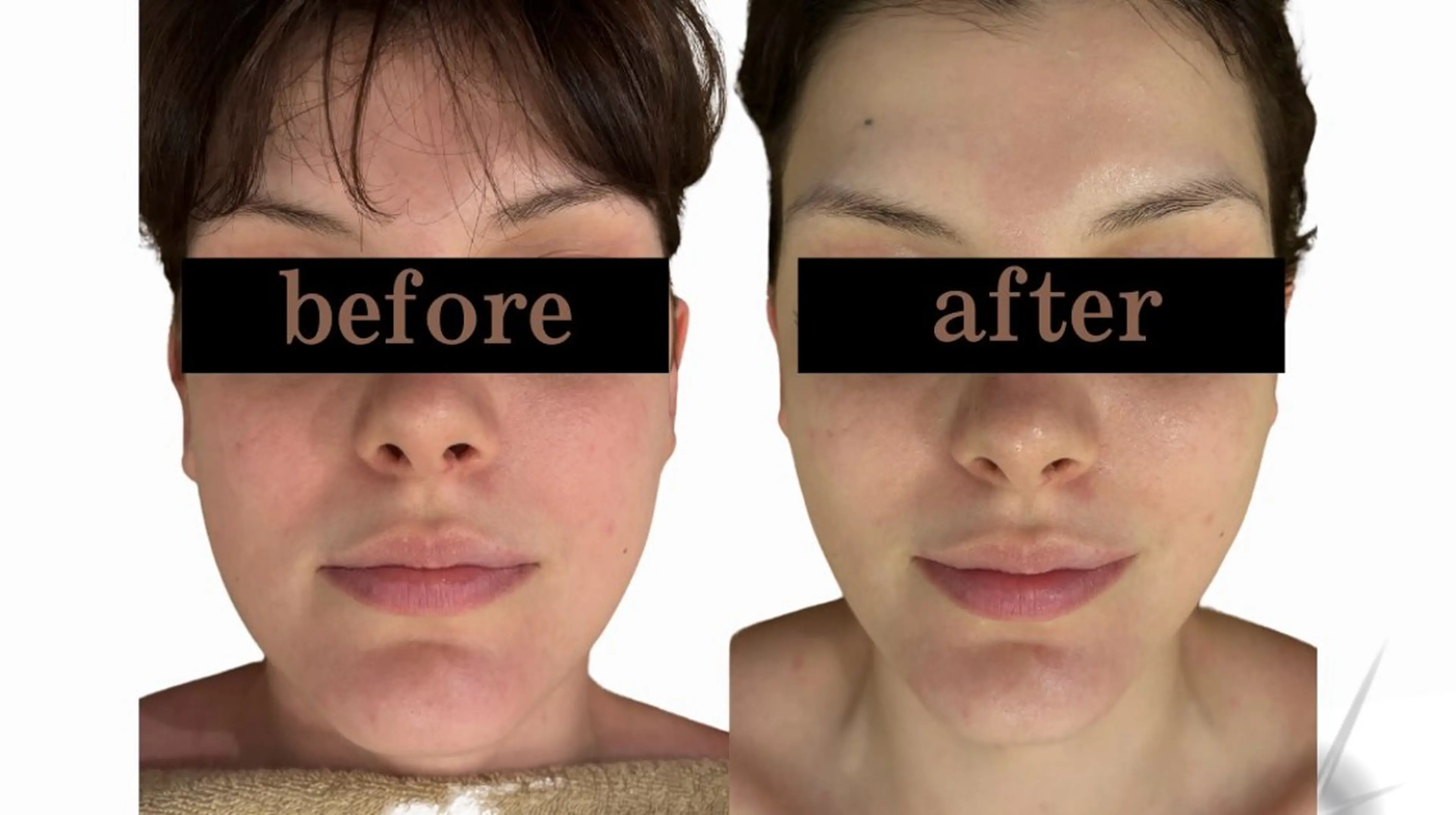 エステ clinical salon enのエステ・リラクイメージ