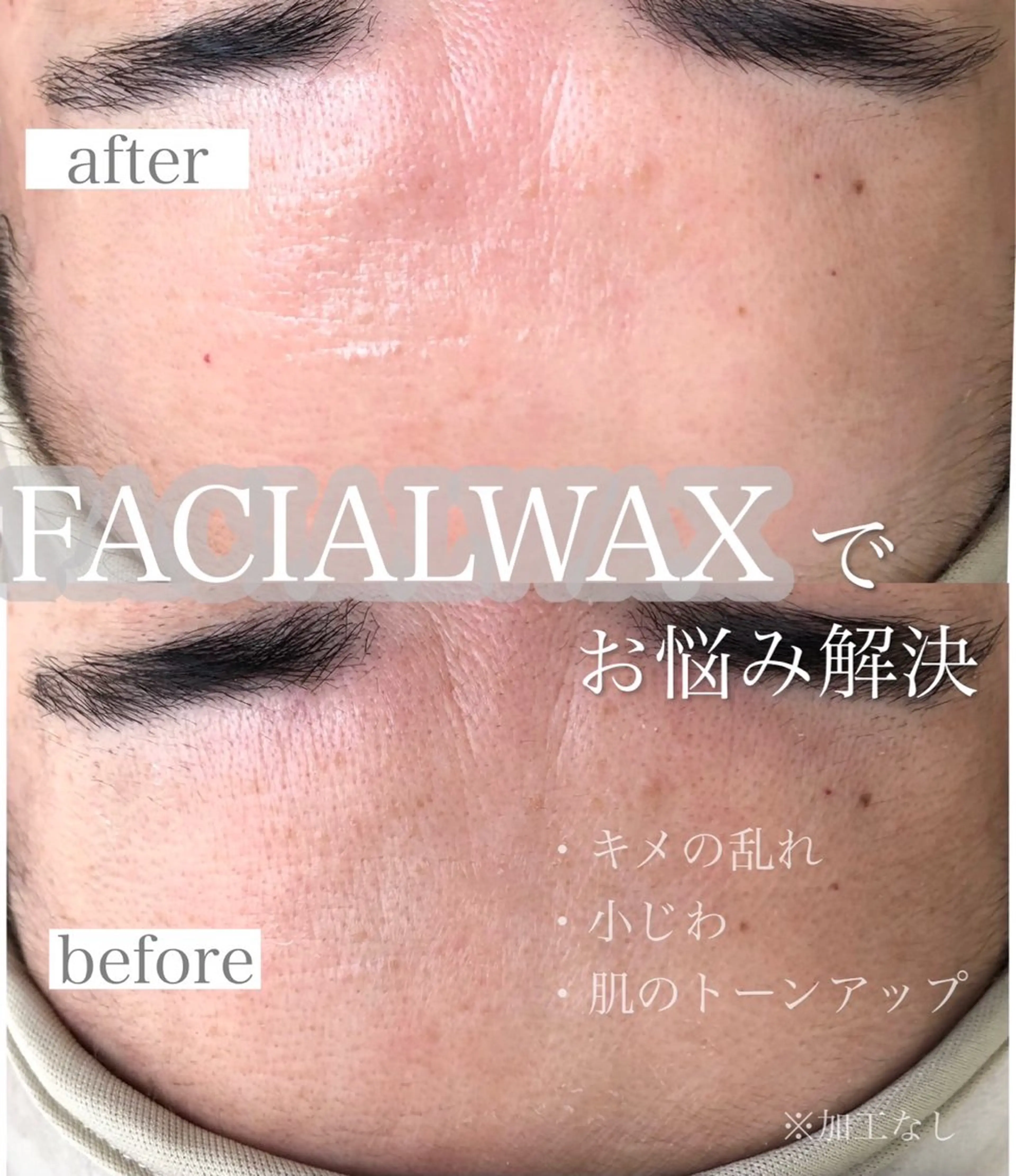 ✨新メニュー導入✨フェイスワックス脱毛［モニター価格］の写真