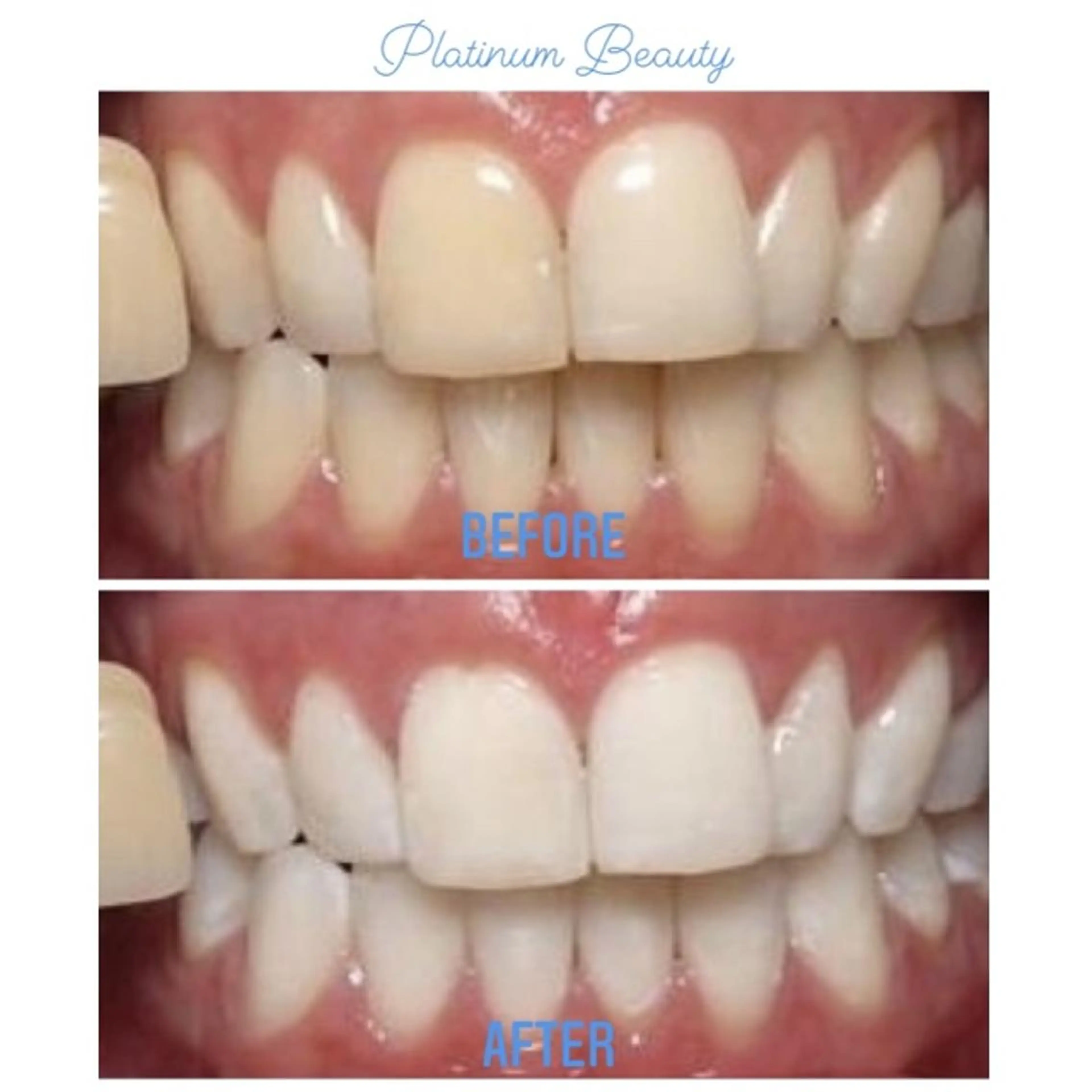 その他 プラティーヌ ボーテのその他イメージ