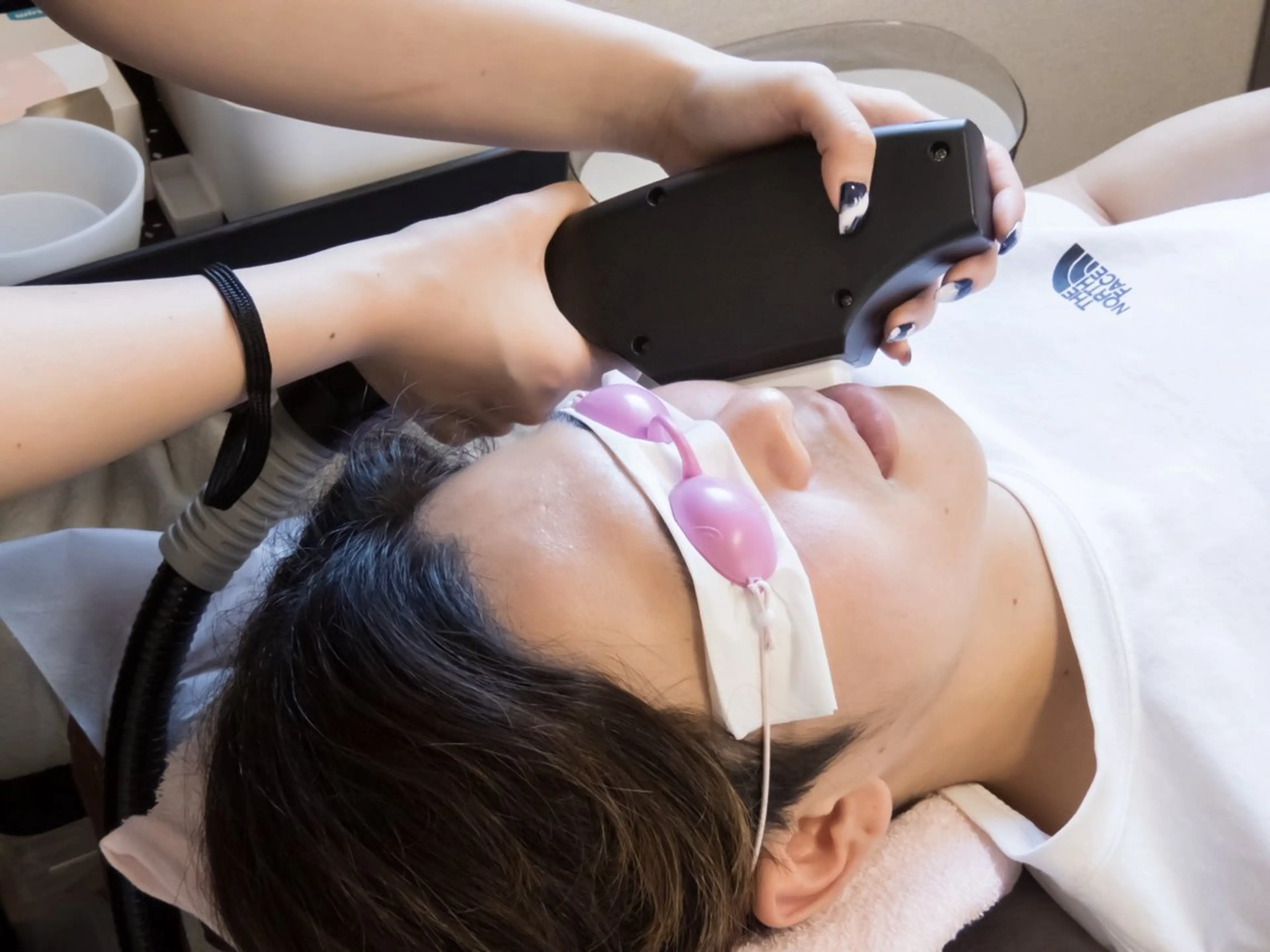 【ミニモ学割U24】《メンズ》ヒゲ脱毛orVIO脱毛 ￥9,980 → ¥3,000の写真