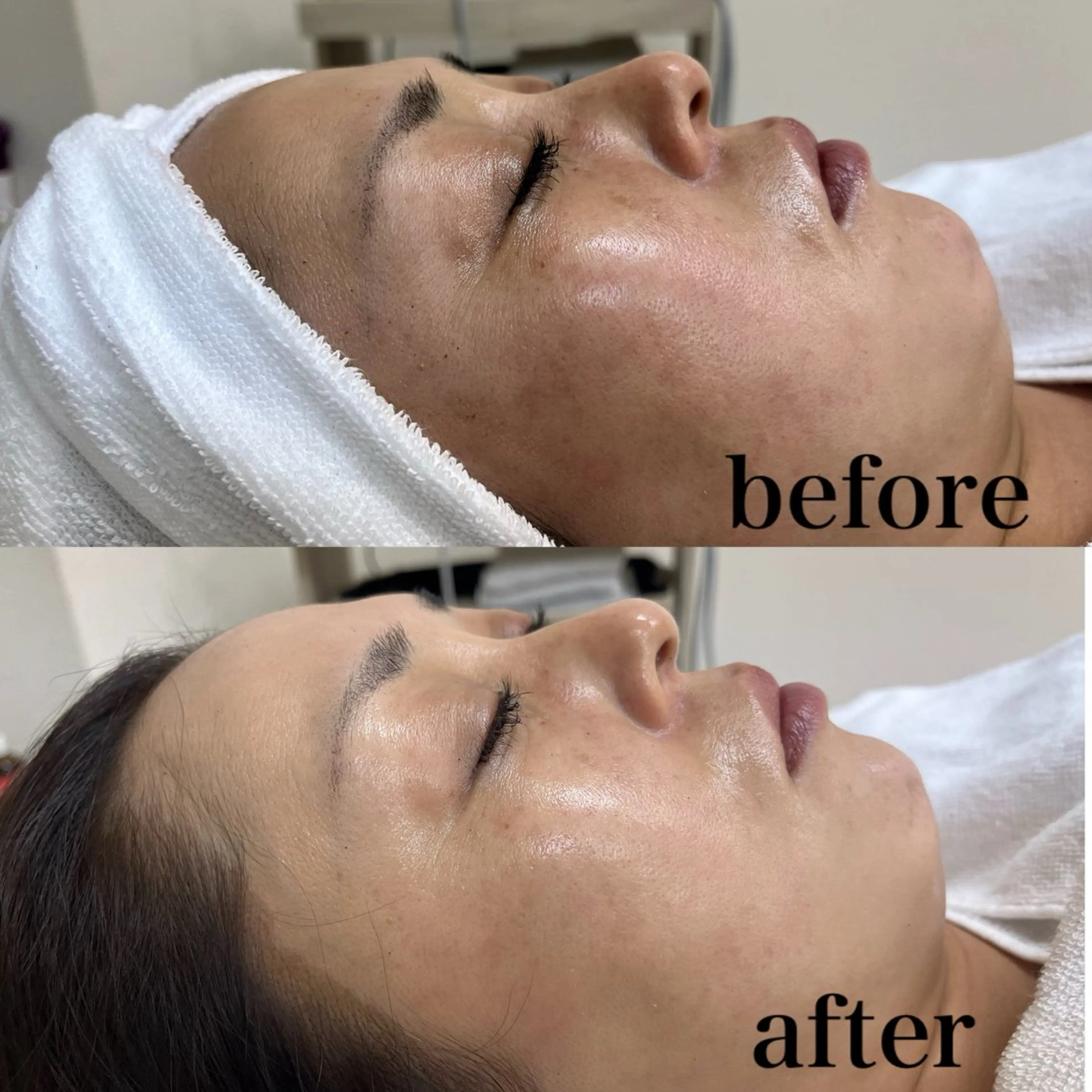 🌺 SAKI 🌺のマツエク・マツパデザイン