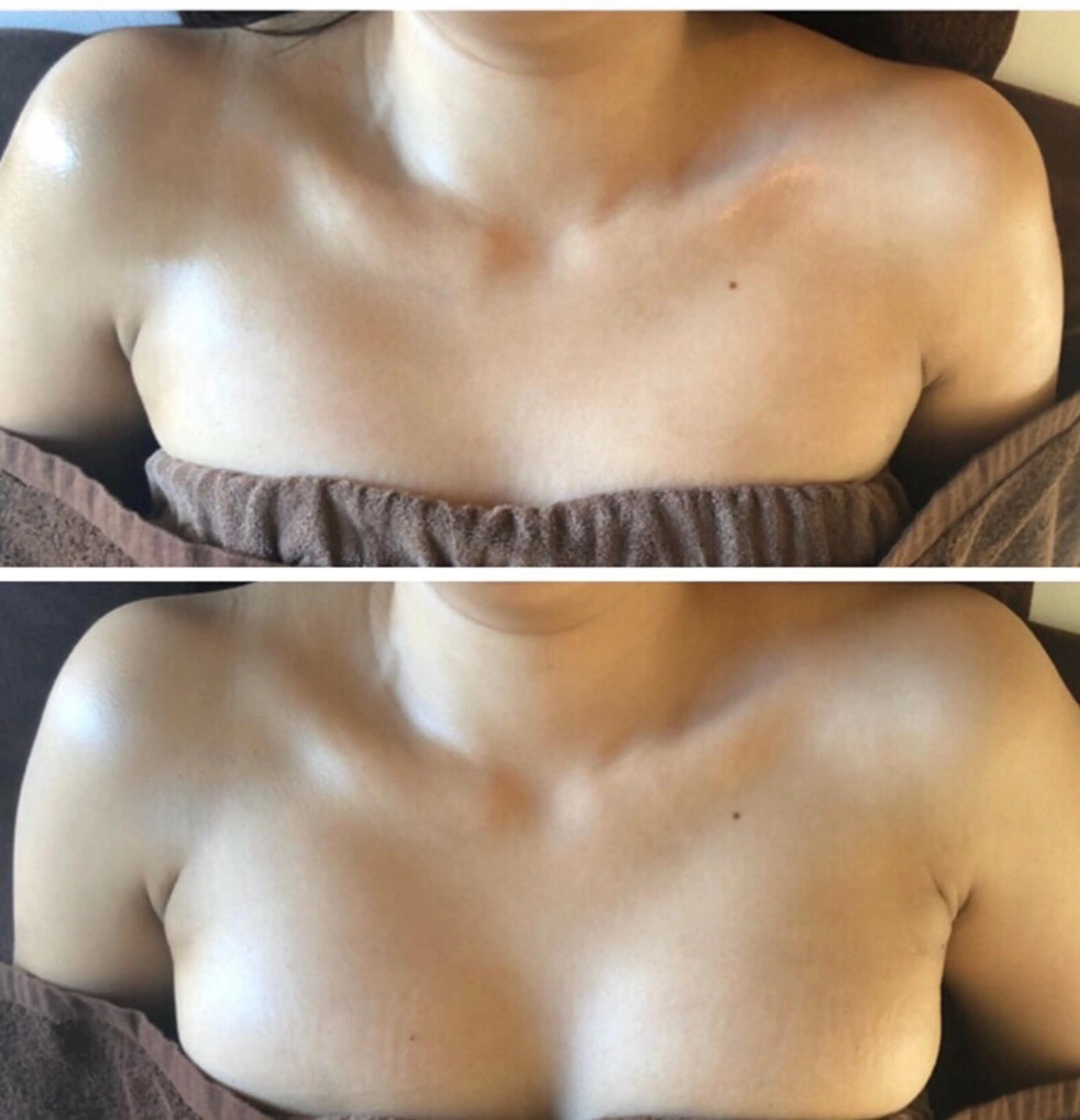 エステ つるんとむき卵肌に 🌟ハーブピーリングのエステ・リラクイメージ