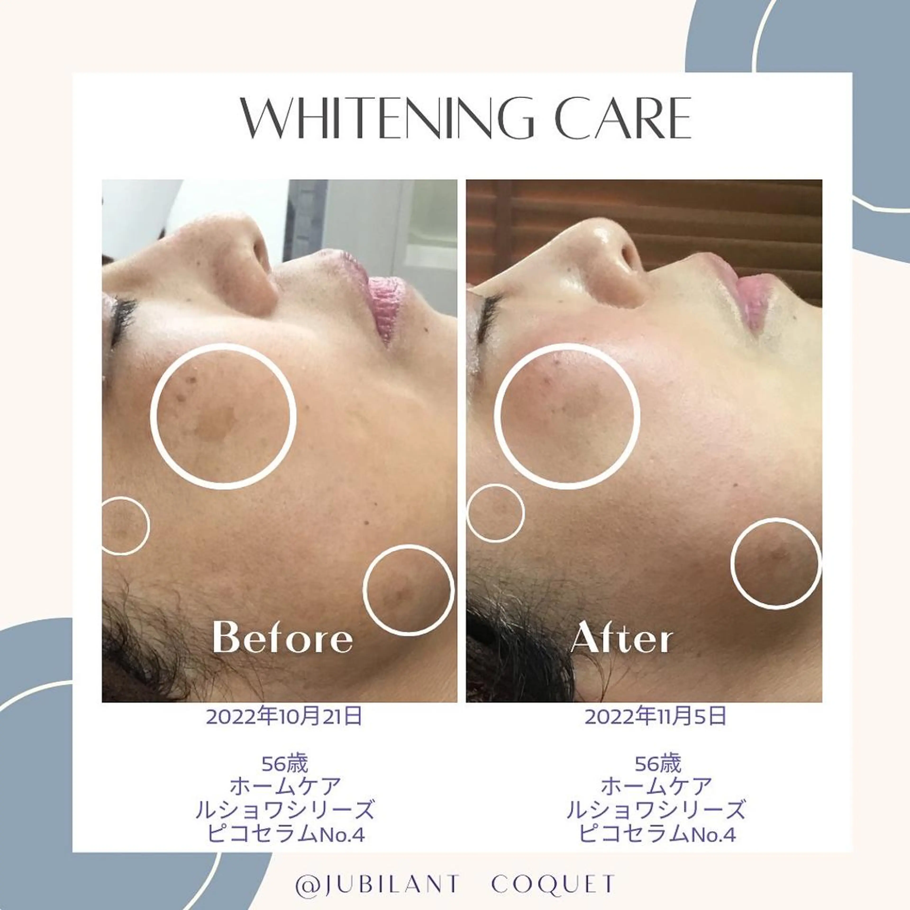 エステティックジュビランCoquet所属・ジュビラン Coquetスタッフのエステ・リラクイメージ