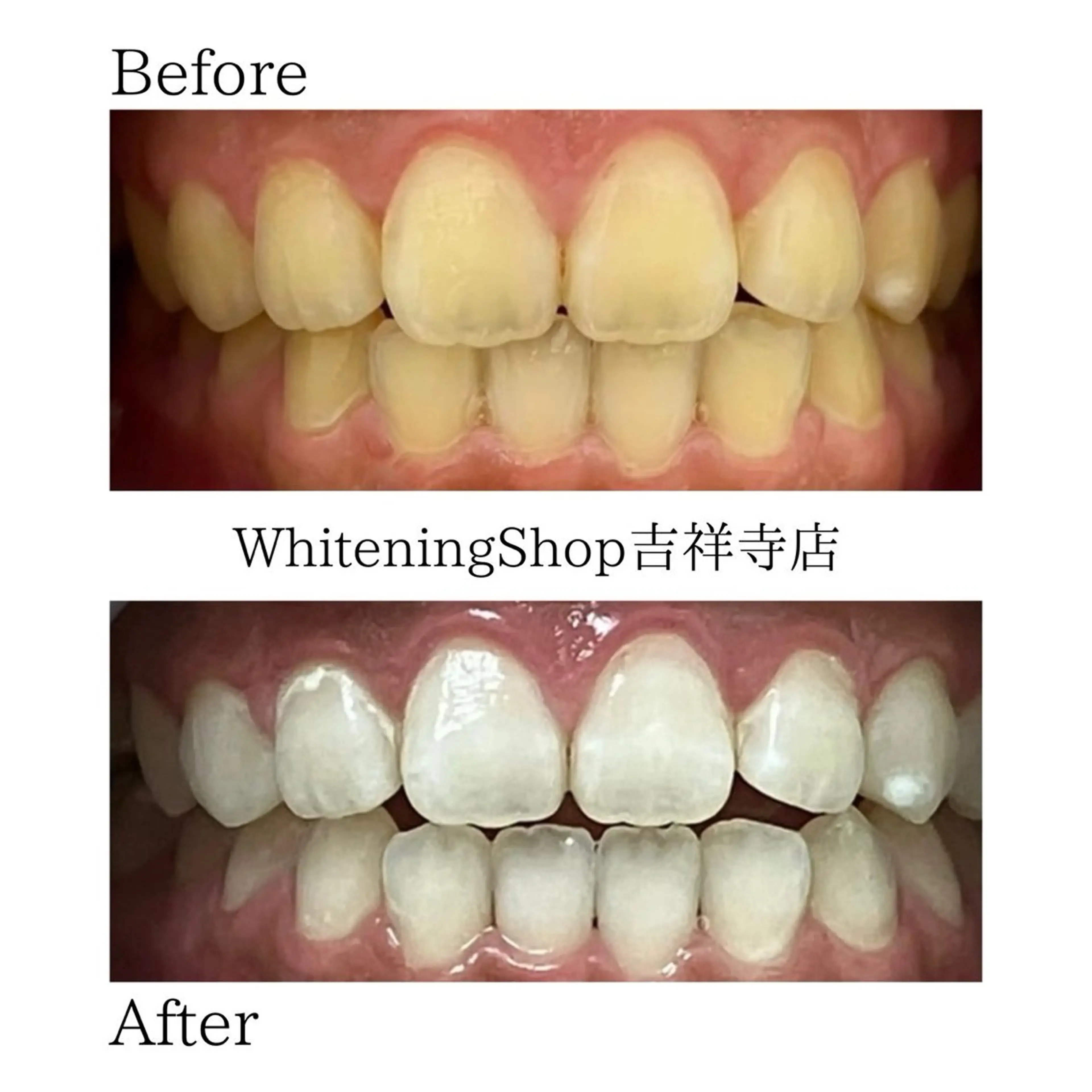 エステ リラク ホワイトニング ショップ吉祥寺店のエステ・リラクイメージ