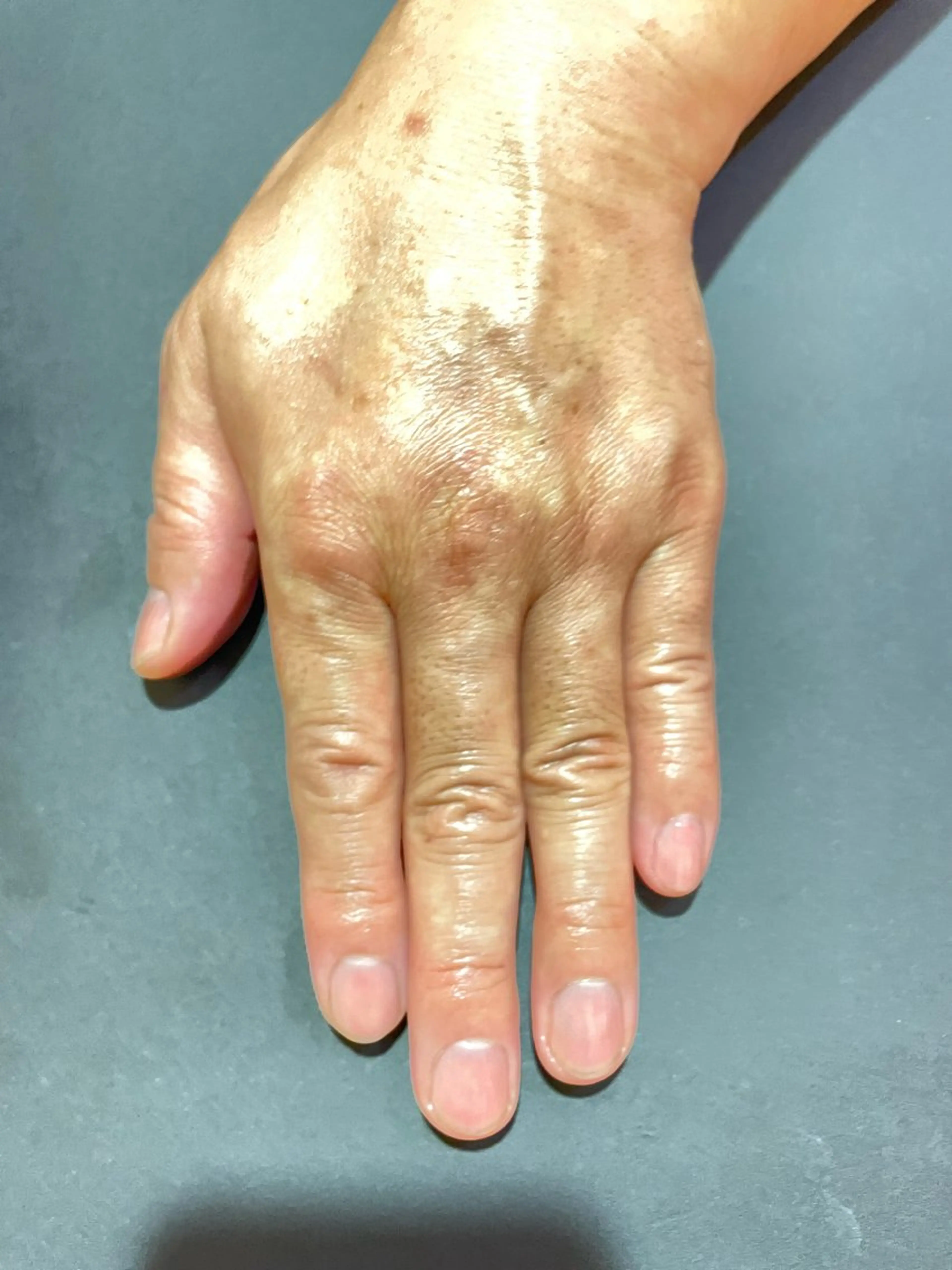 ネイル メンズネイル 荒井 恵のネイルデザイン