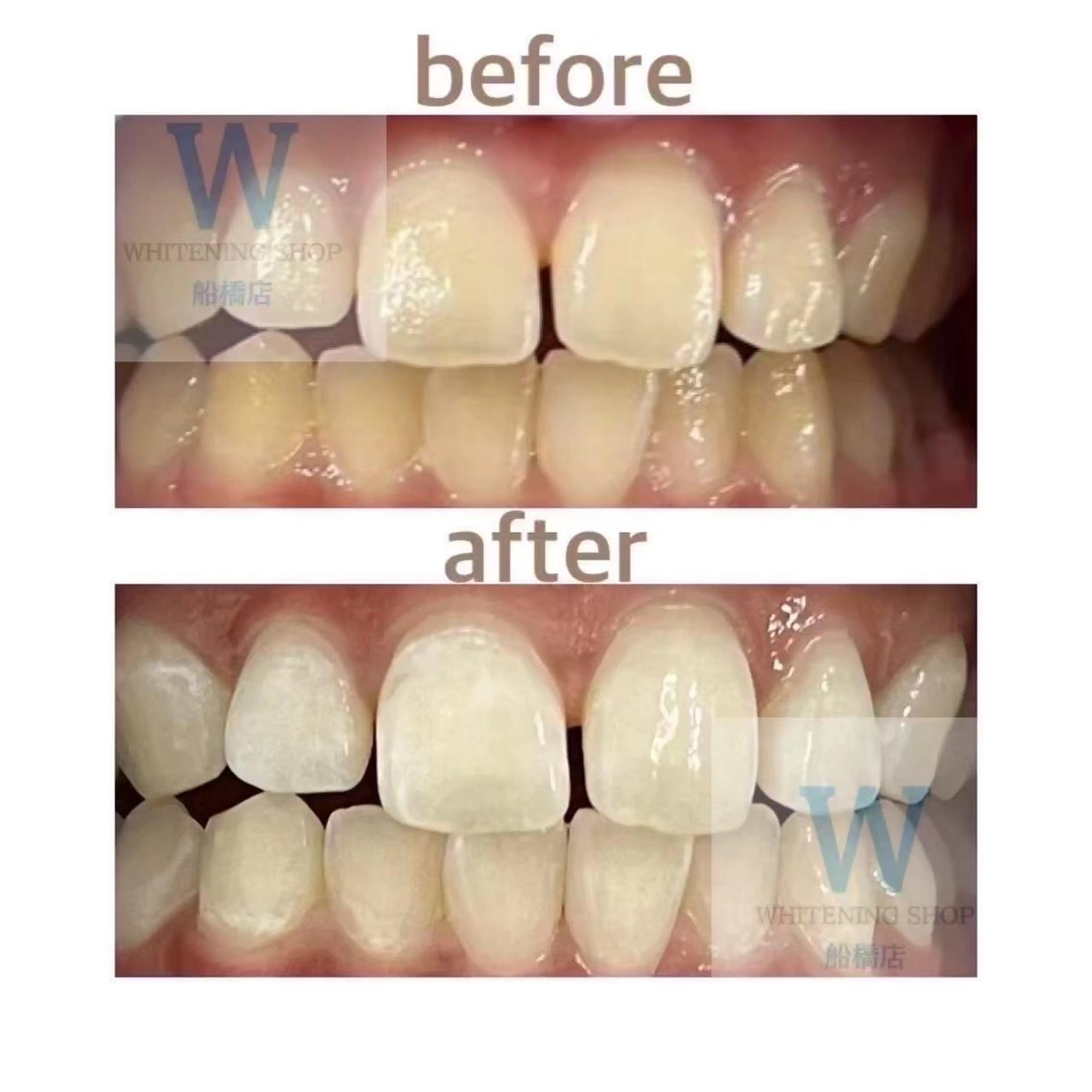 エステ リラク ホワイトニング ショップ船橋店🦷のエステ・リラクイメージ