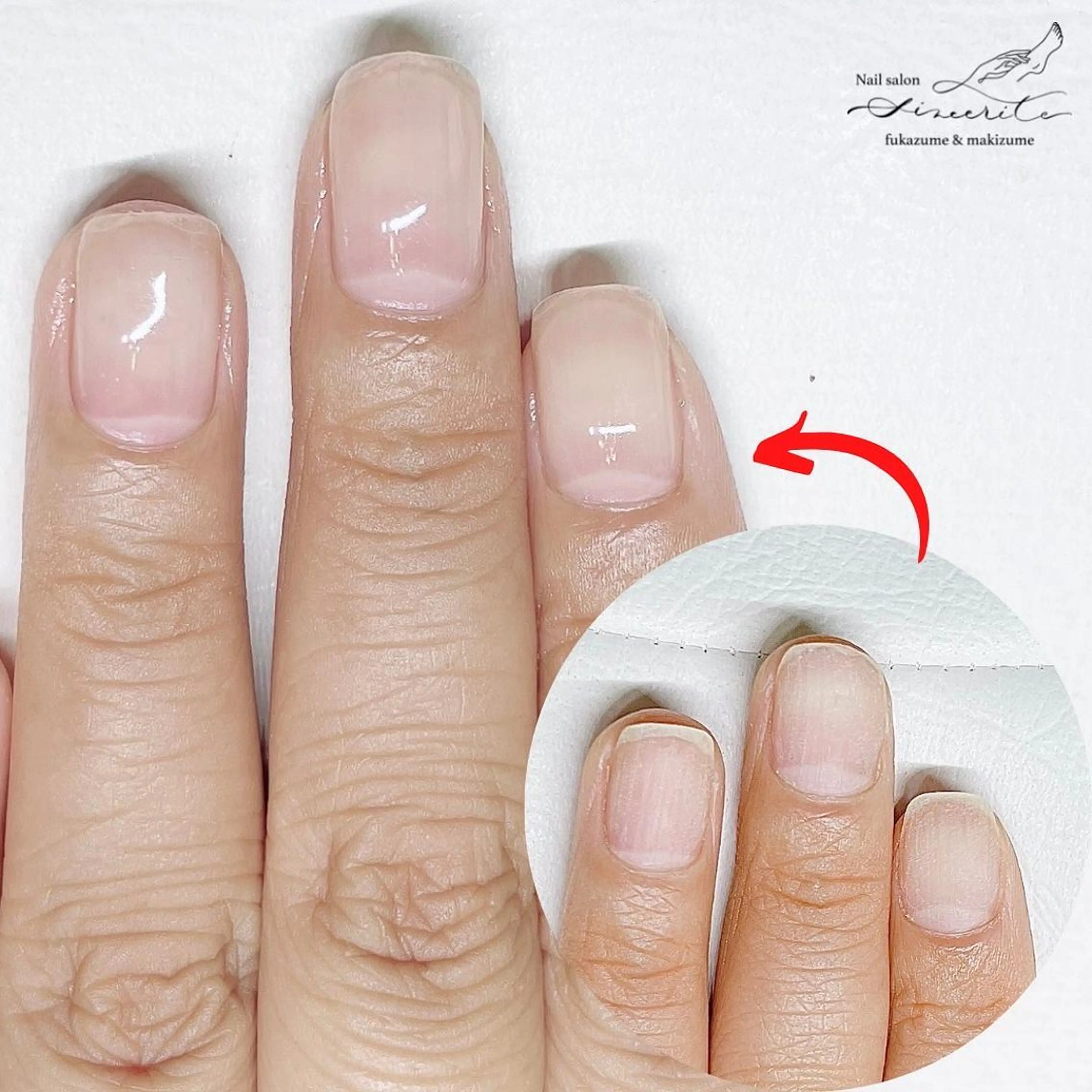 ネイル 深爪・巻き爪 専門サンセリテのネイルデザイン
