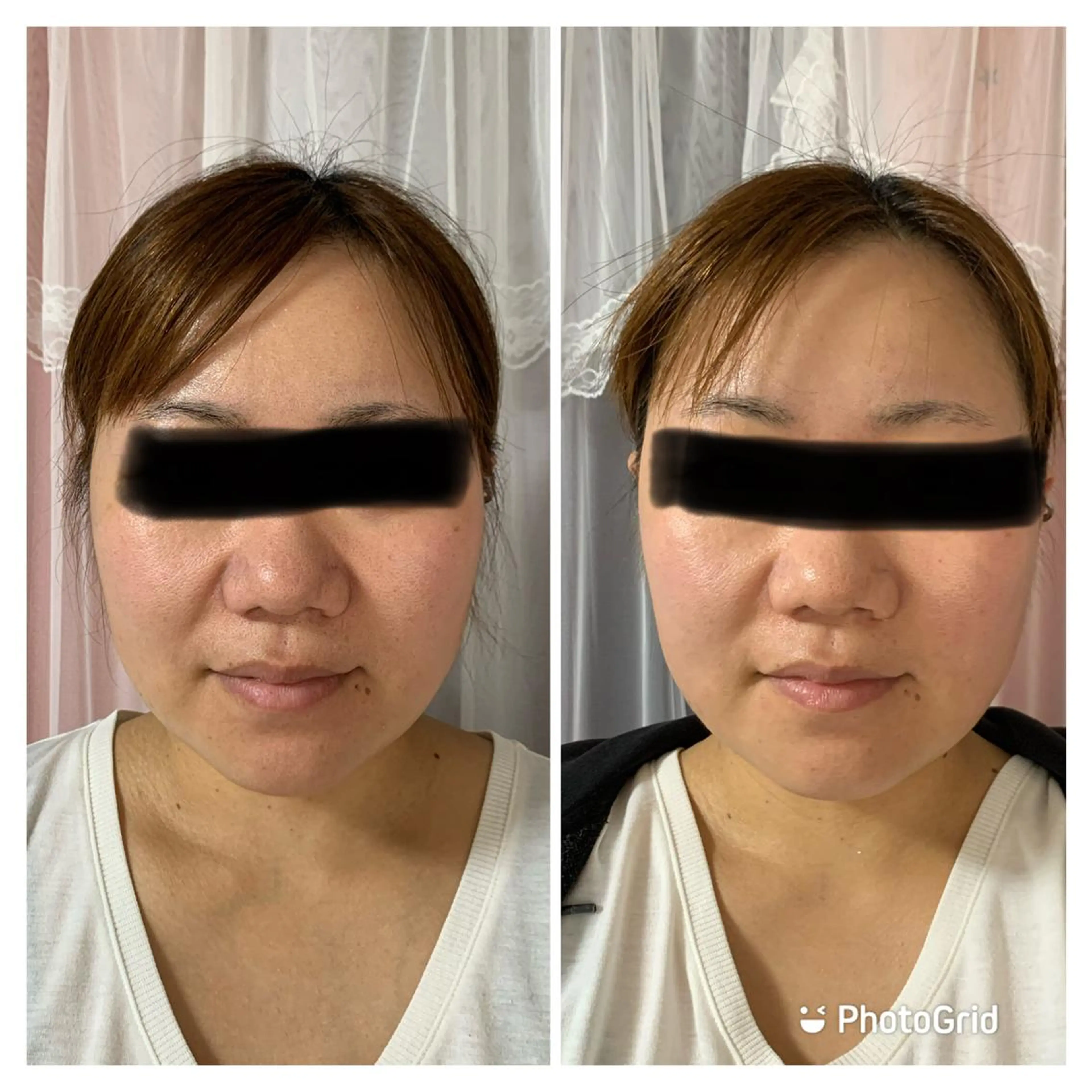 ショート LUCIALL  ルシアル所属・児玉 愛由美のエステ・リラクイメージ