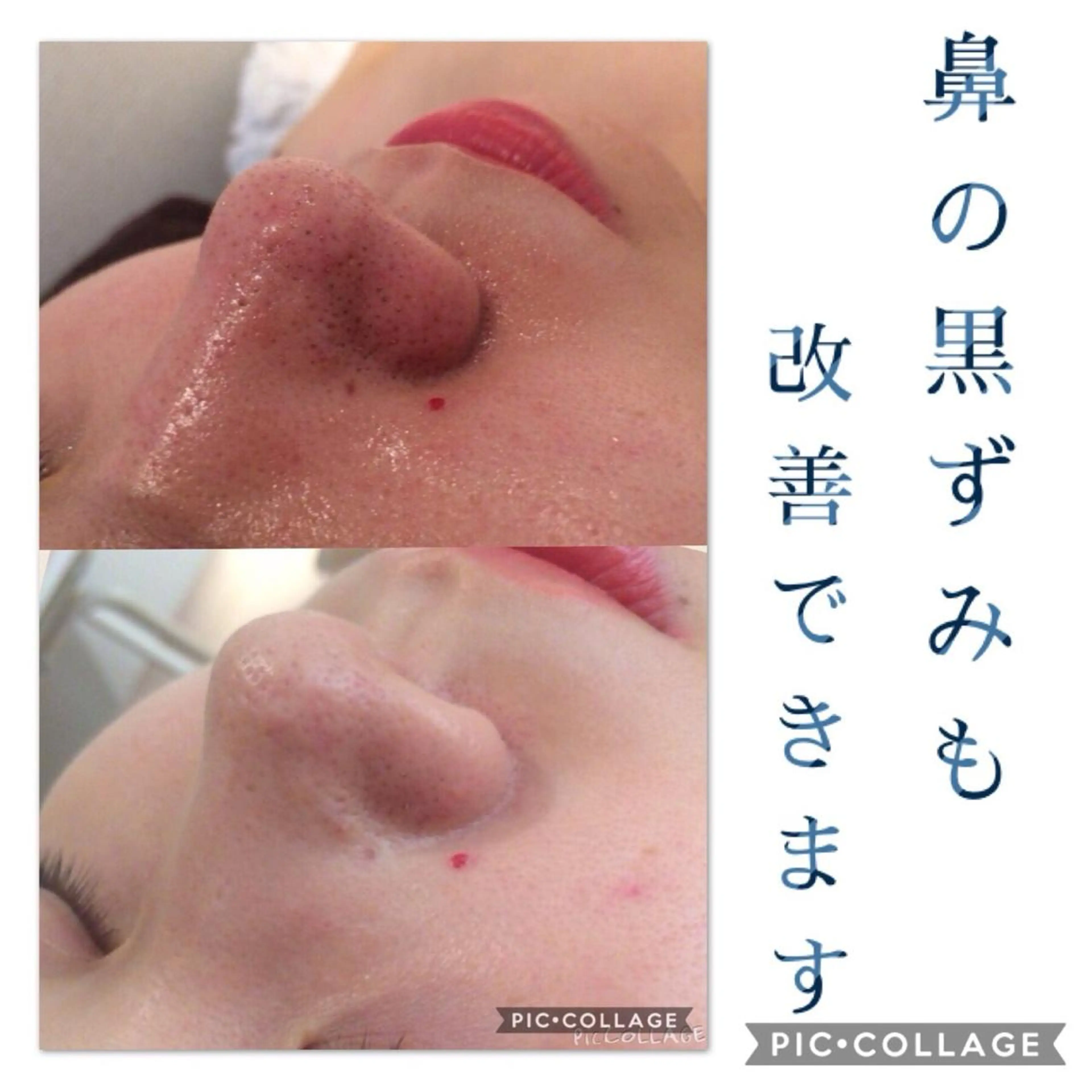 ミディアム カラー パーマ ヘアアレンジ メンズ キッズ ネイル マツエク・マツパ ニキビ・肌質改善専門 ♡人生が変わるサロンのエステ・リラクイメージ