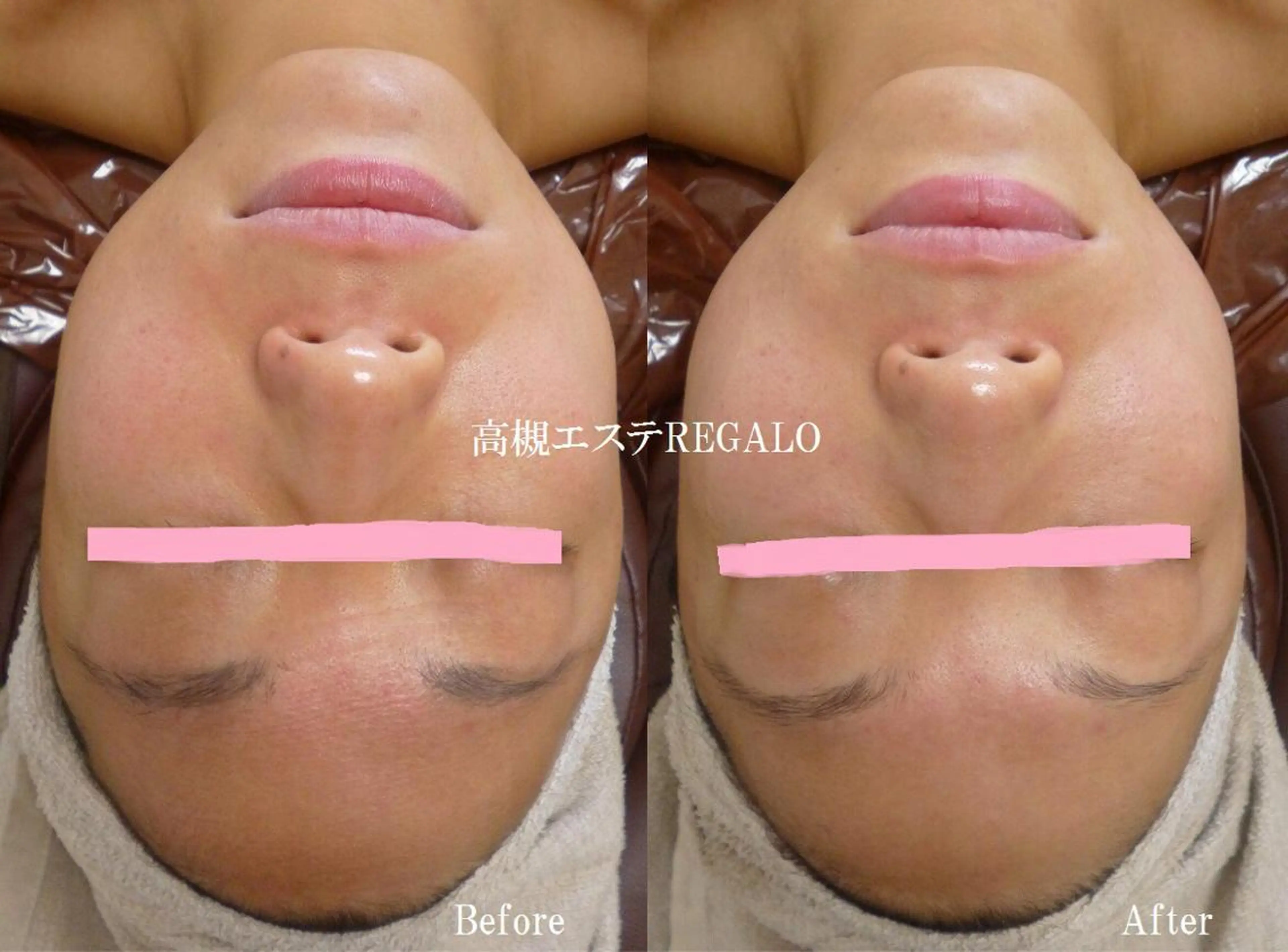 エステ REGALO所属・矢野 さやかのエステ・リラクイメージ