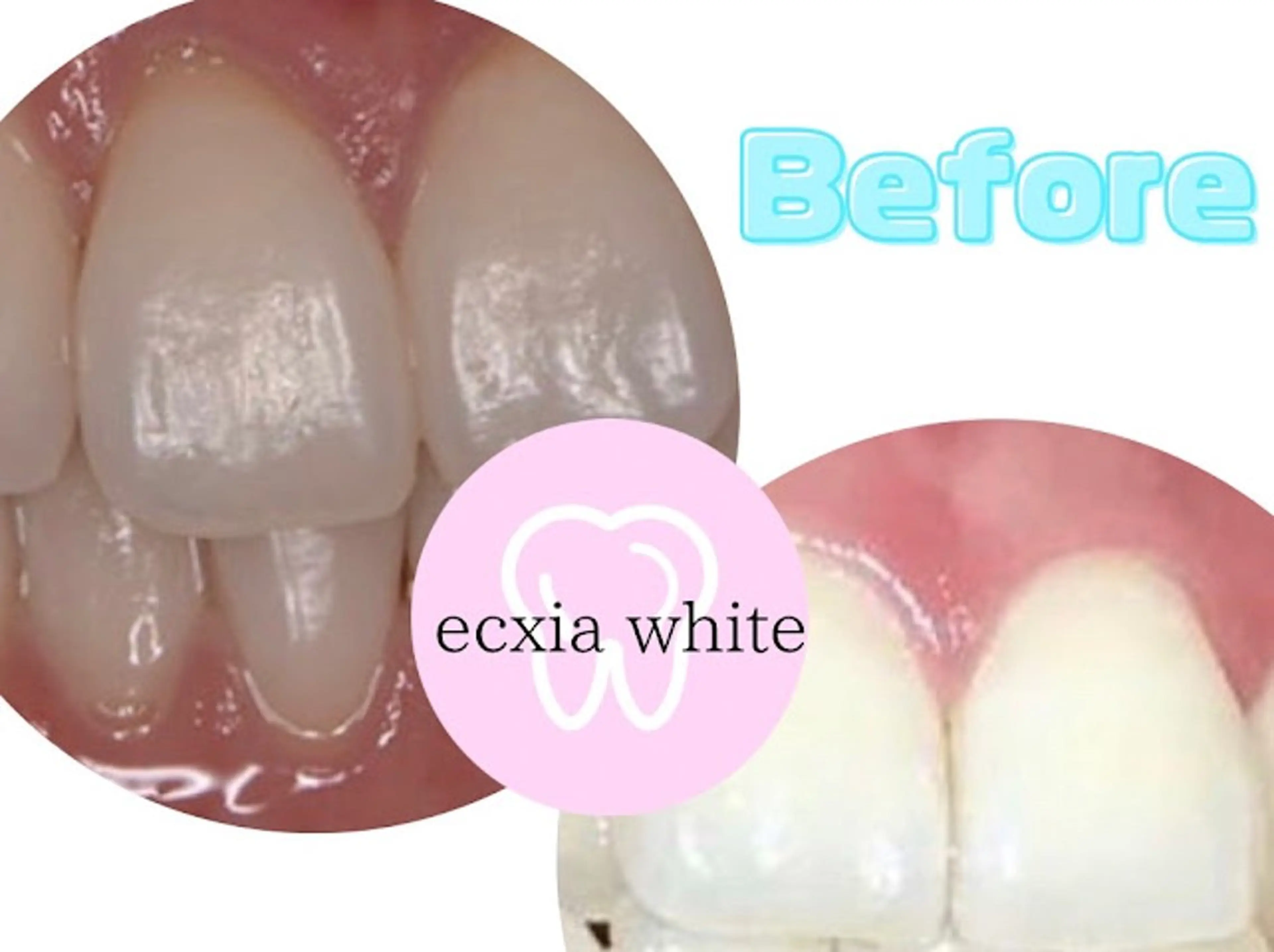 セルフホワイトニング エクシア浜松店のその他イメージ