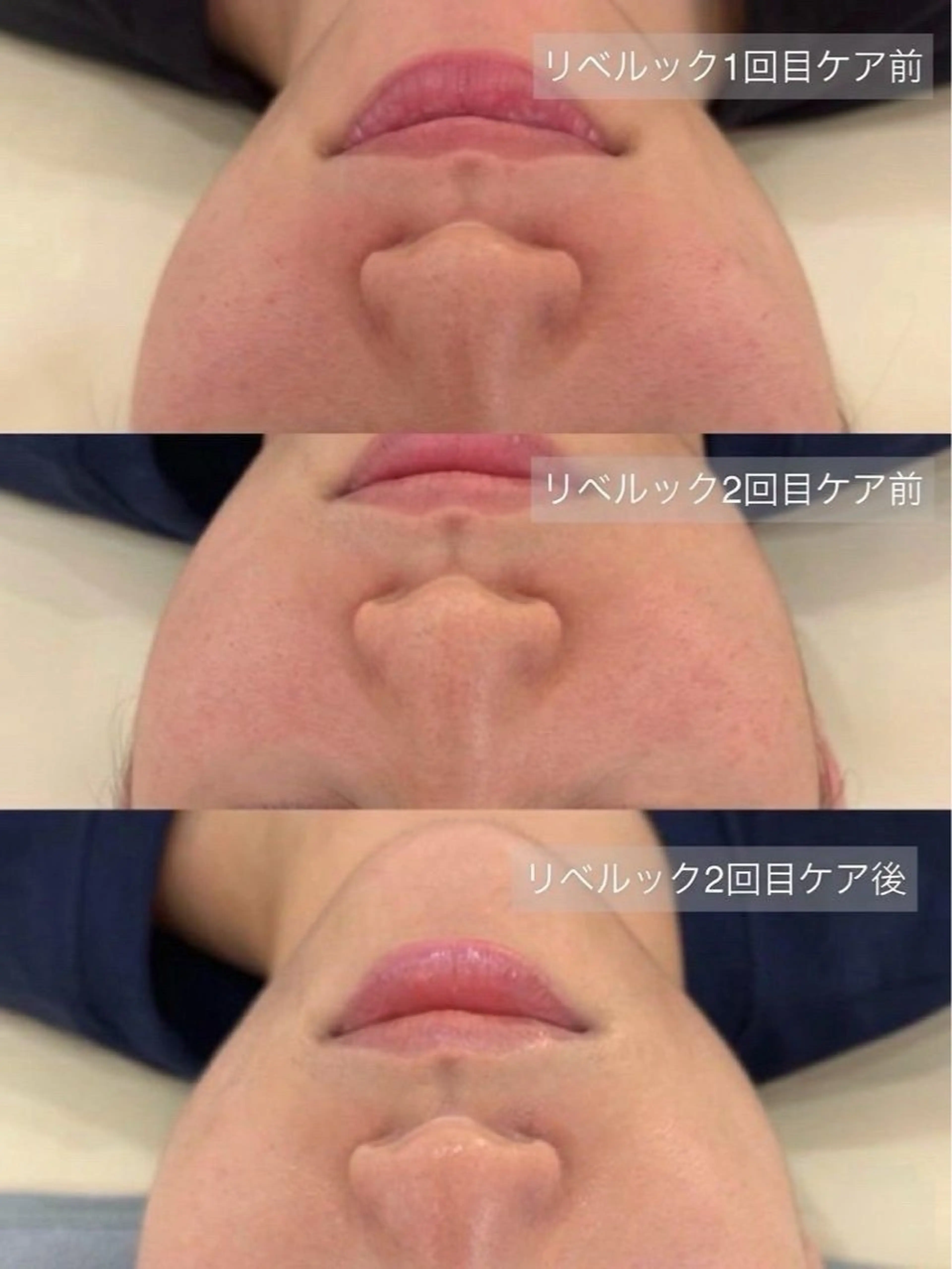 エステ SalonJewel 品川店のエステ・リラクイメージ
