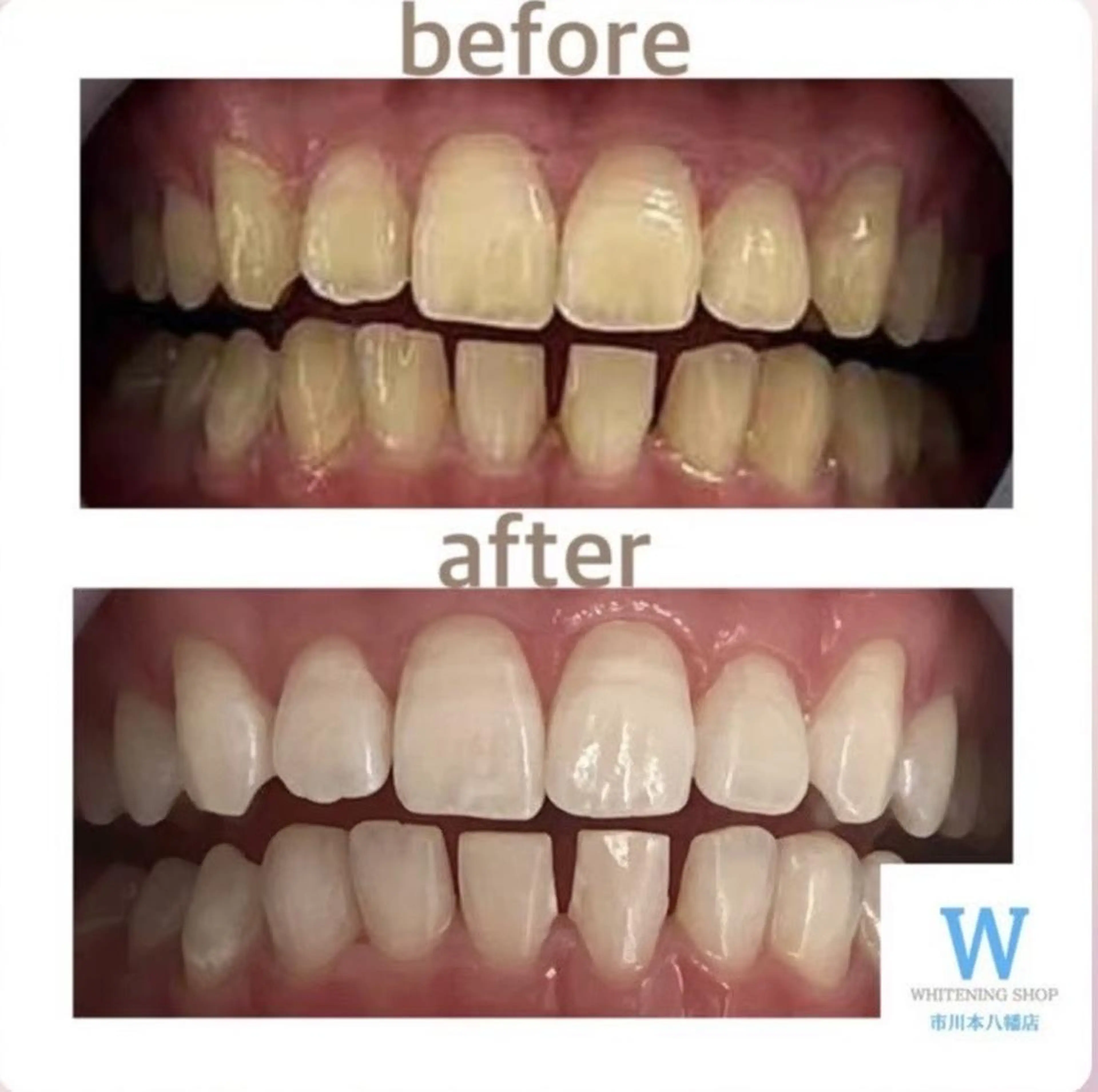 エステ リラク ホワイトニング ショップ本八幡店のエステ・リラクイメージ