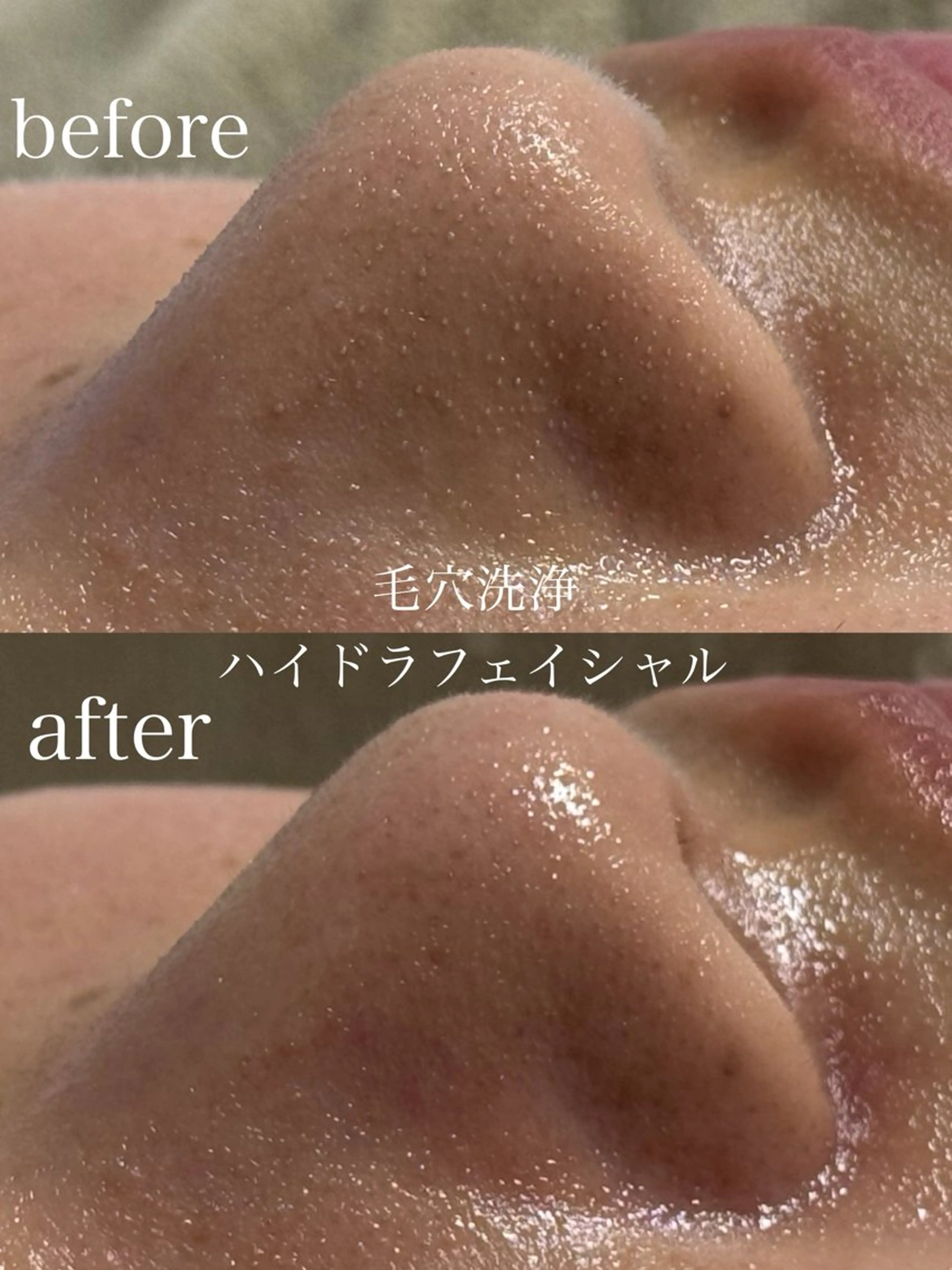 エステ フェイシャルサロン CHIARA鈴木のエステ・リラクイメージ