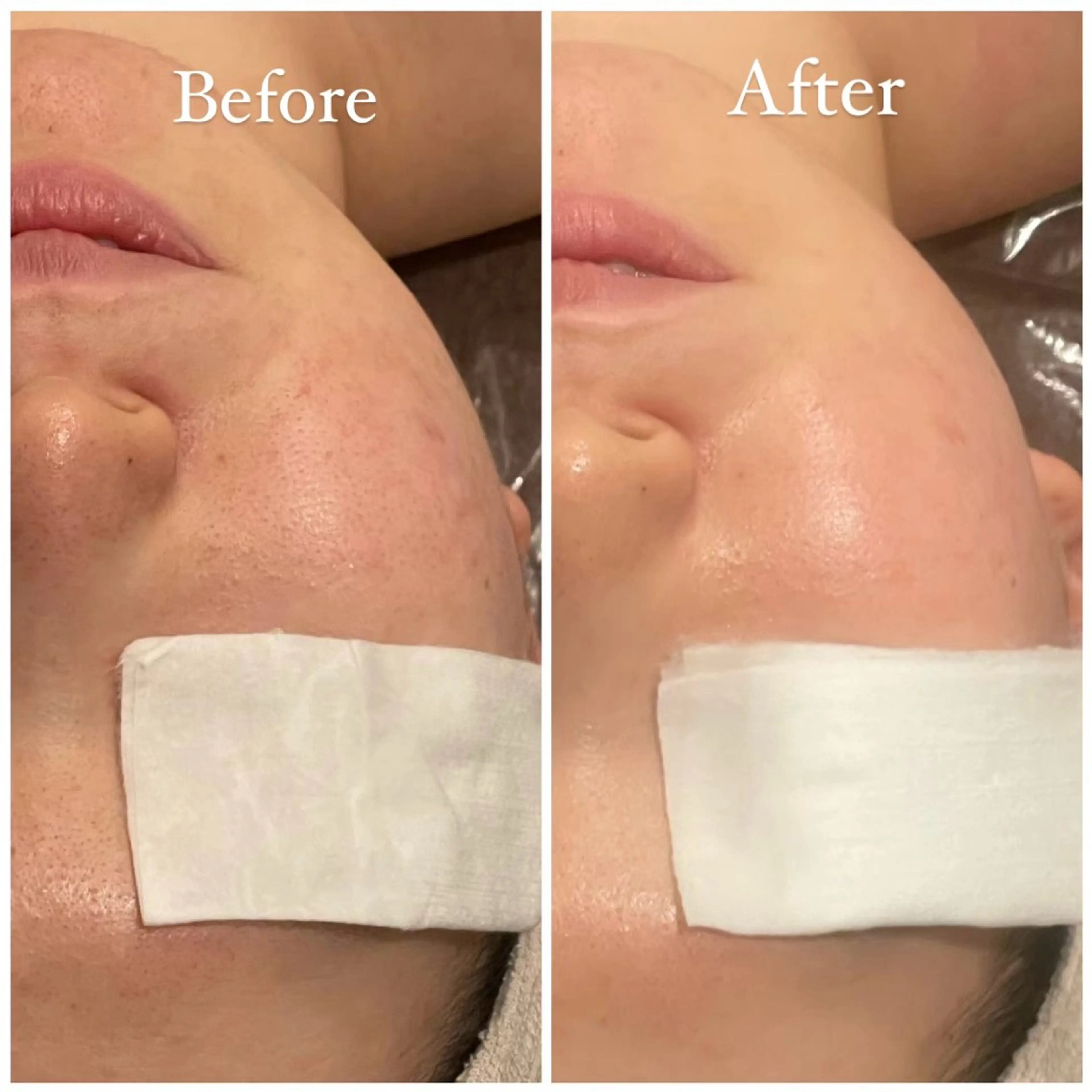 Tulipe Chihoのエステ・リラクイメージ