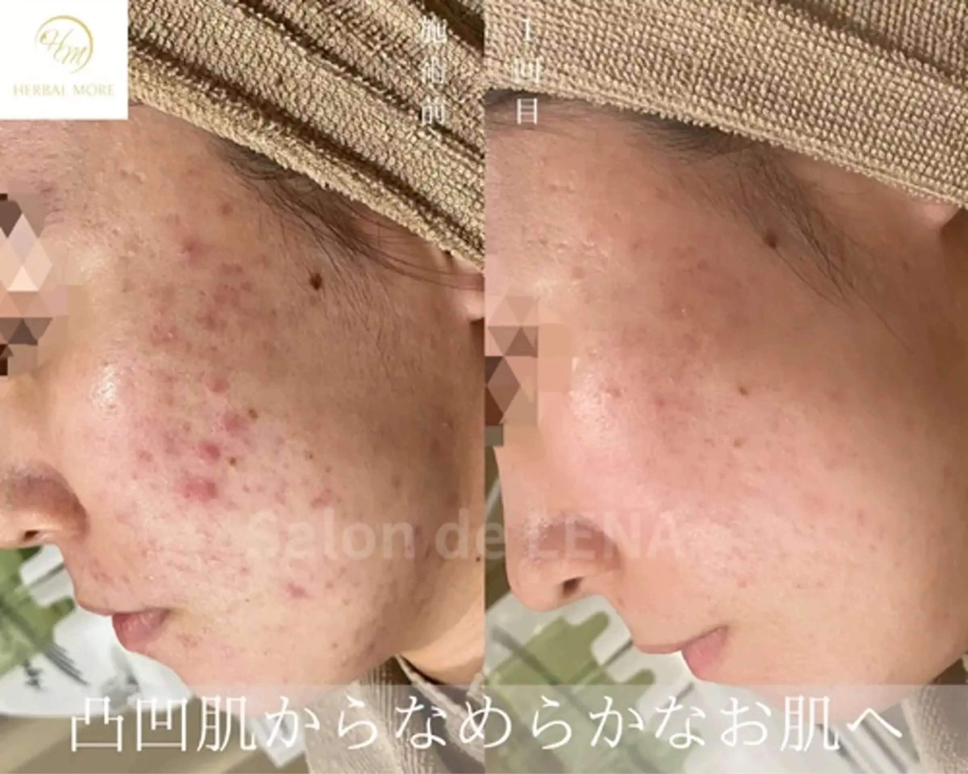 ハーブピーリング専門 グランディール　武内のエステ・リラクイメージ