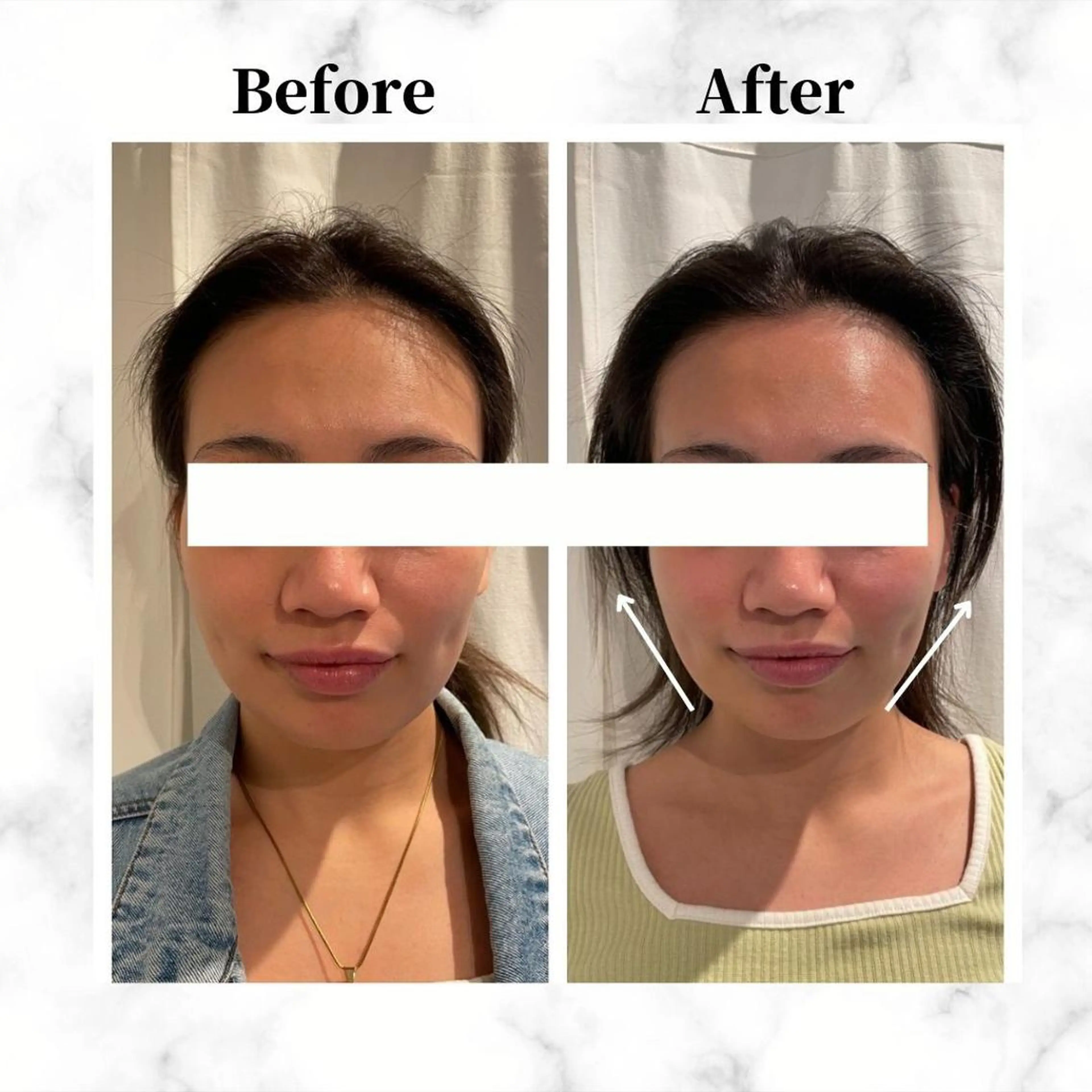 12Dハイフ💗 最強小顔のエステ・リラクイメージ