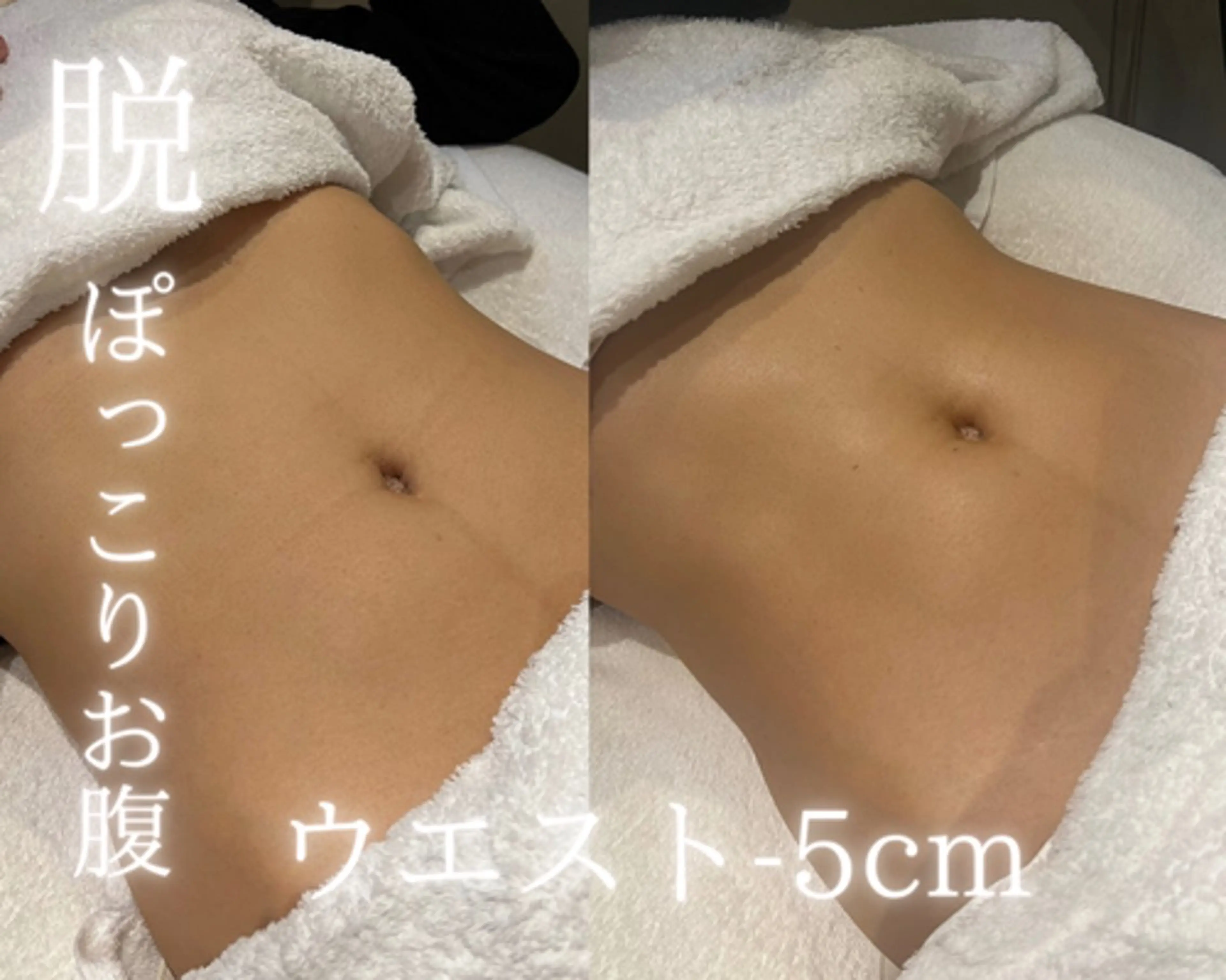 エステ リラク 肌管理サロン vidyto　MOEのエステ・リラクイメージ