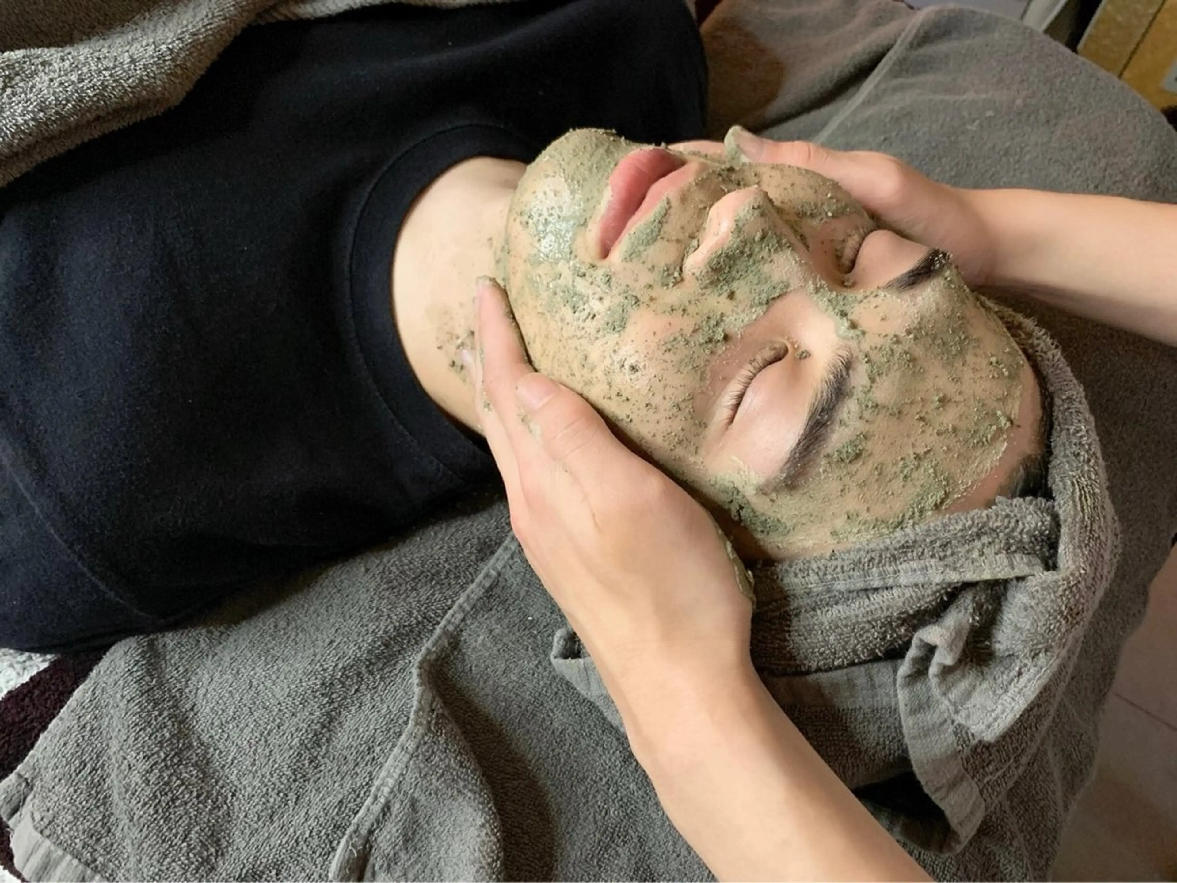 【メンズ専用】初めてのニキビケアにも☆剥離なしハーブピーリングの写真