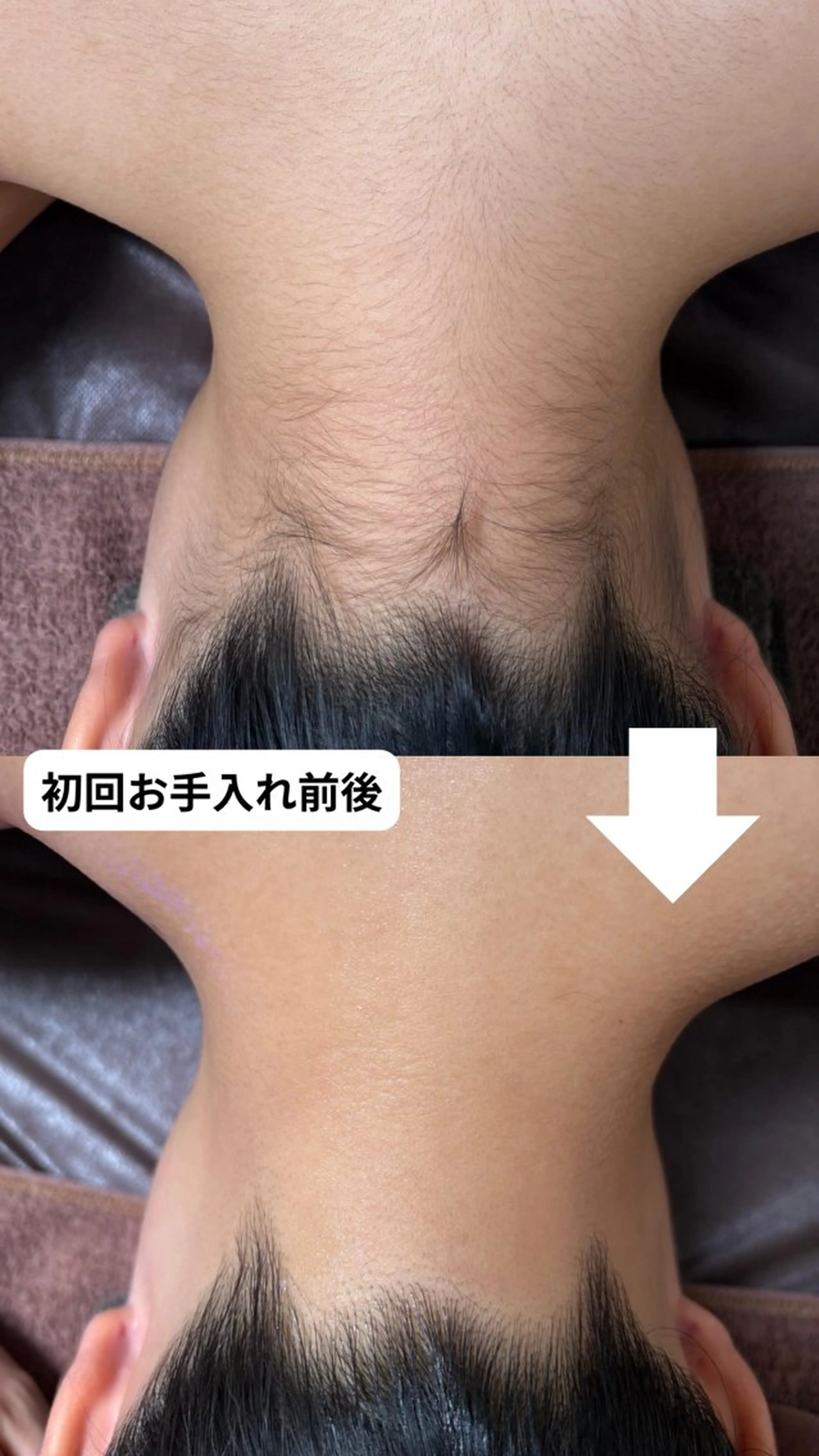 脱毛 脱毛専門店 Angemのエステ・リラクイメージ