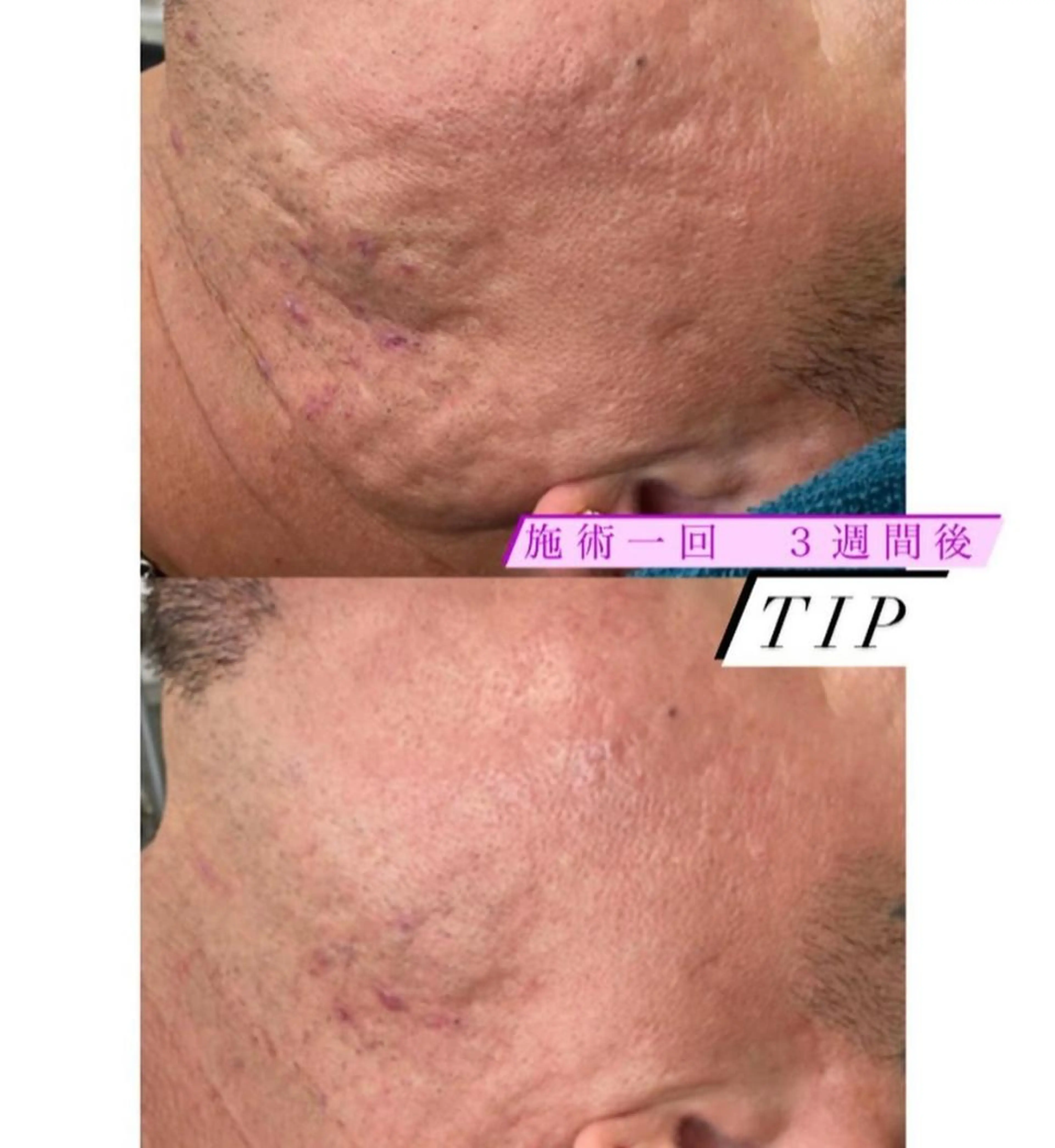 エステ フェイシャル専門 肌質改善/プランスのエステ・リラクイメージ