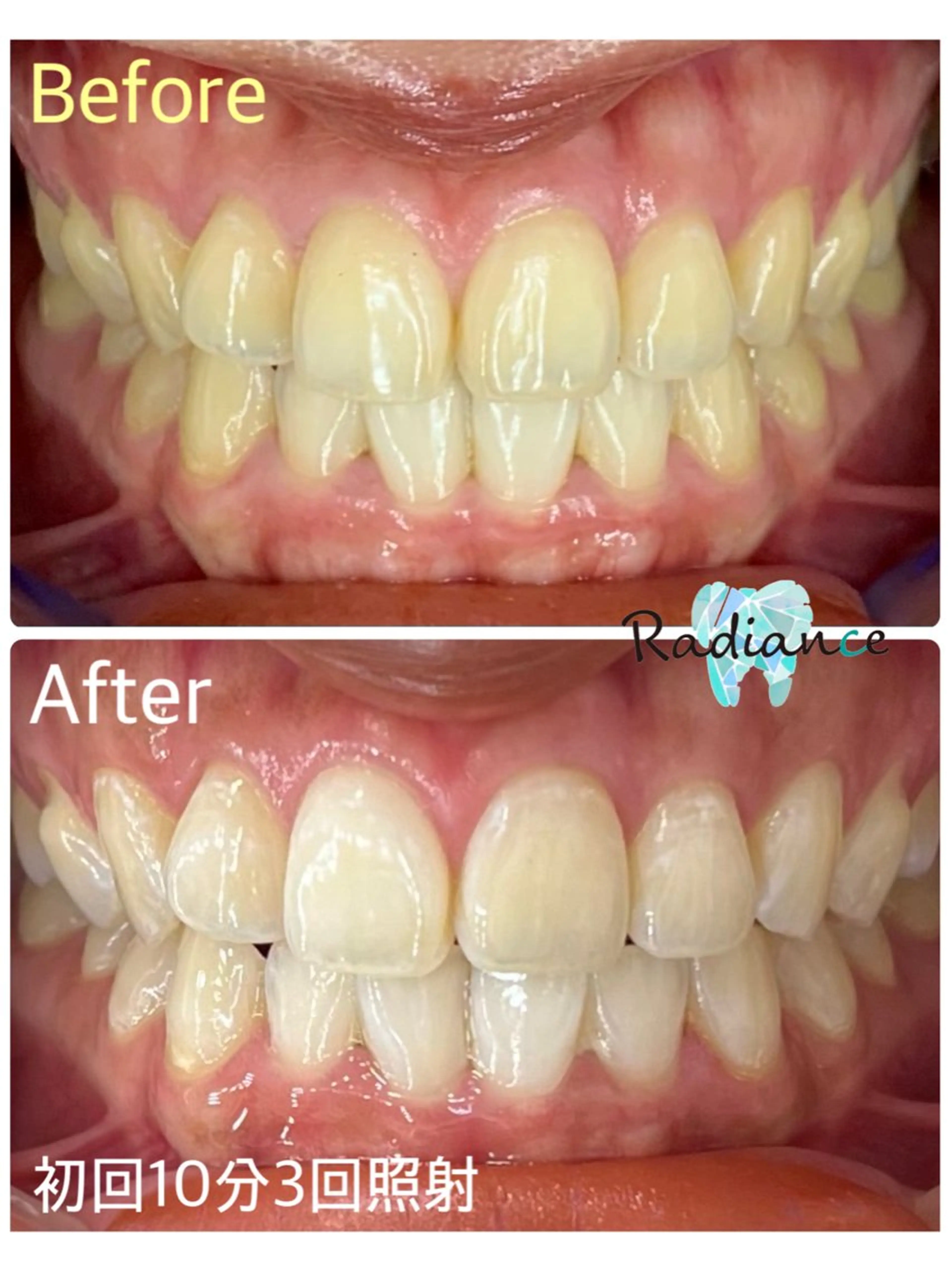 その他 札幌ホワイトニング ラディアンス札幌駅店のその他イメージ