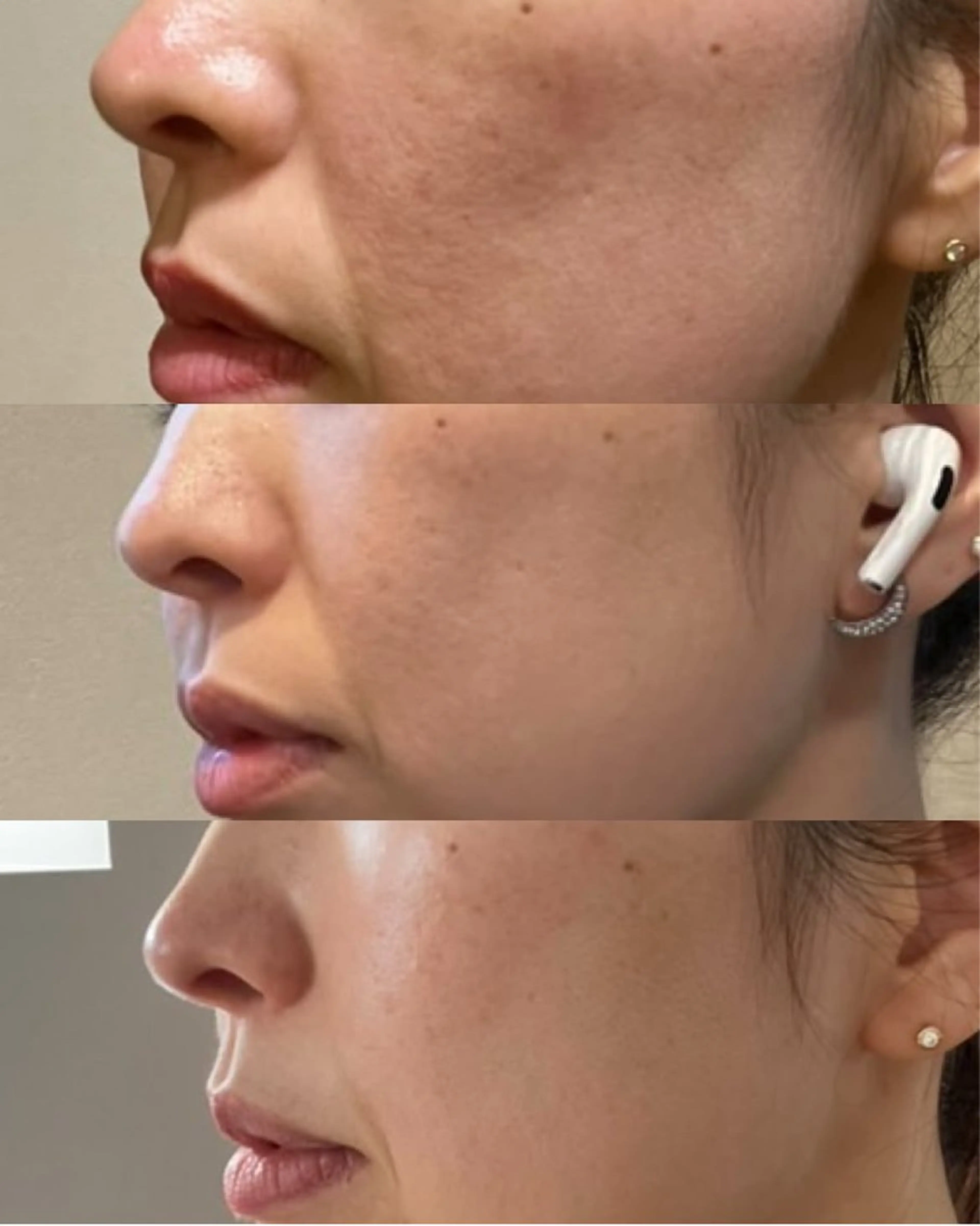 Blooming所属・LOUISE. ／肌質・頭皮のエステ・リラクイメージ