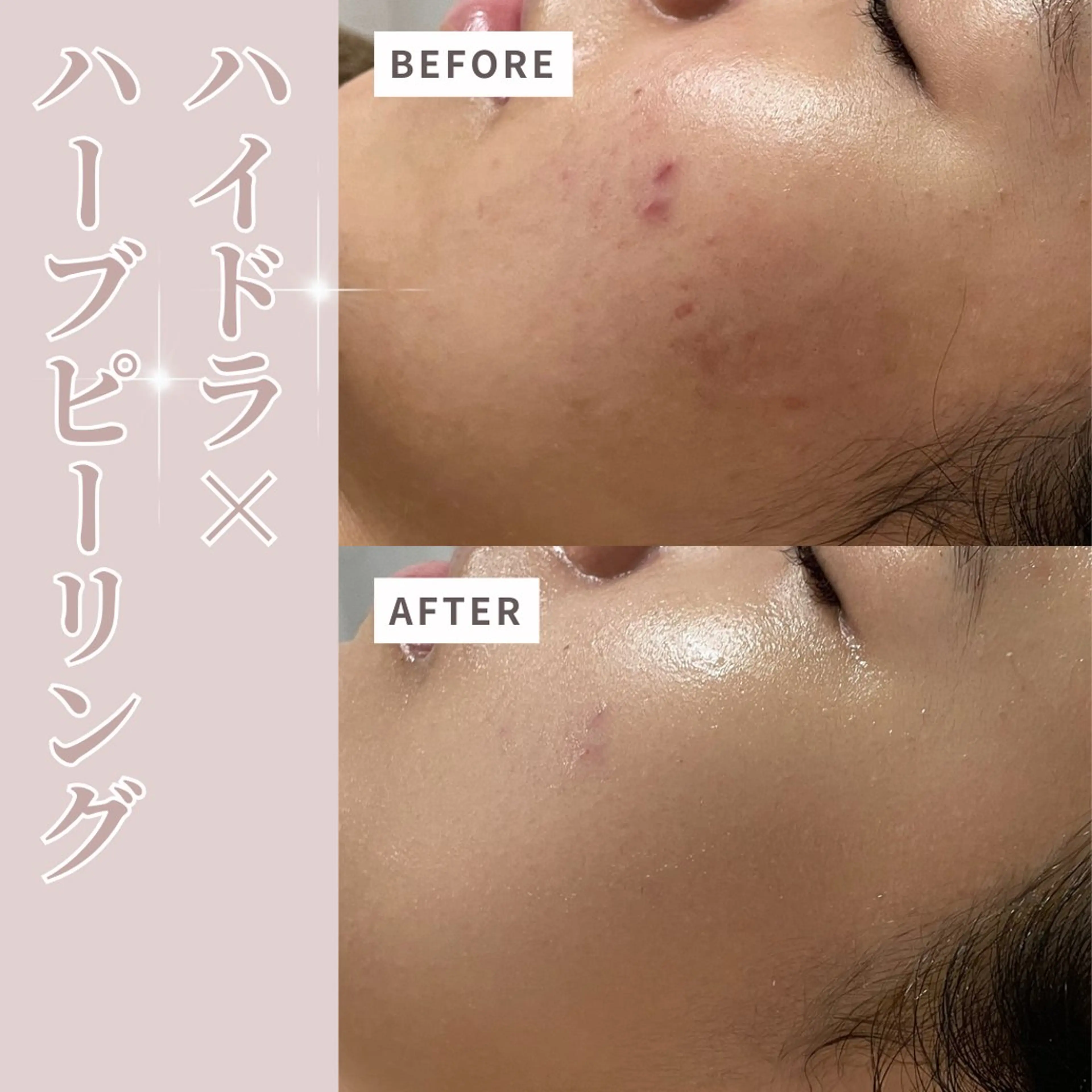 エステ プライベートサロン Belle（ベル）のエステ・リラクイメージ