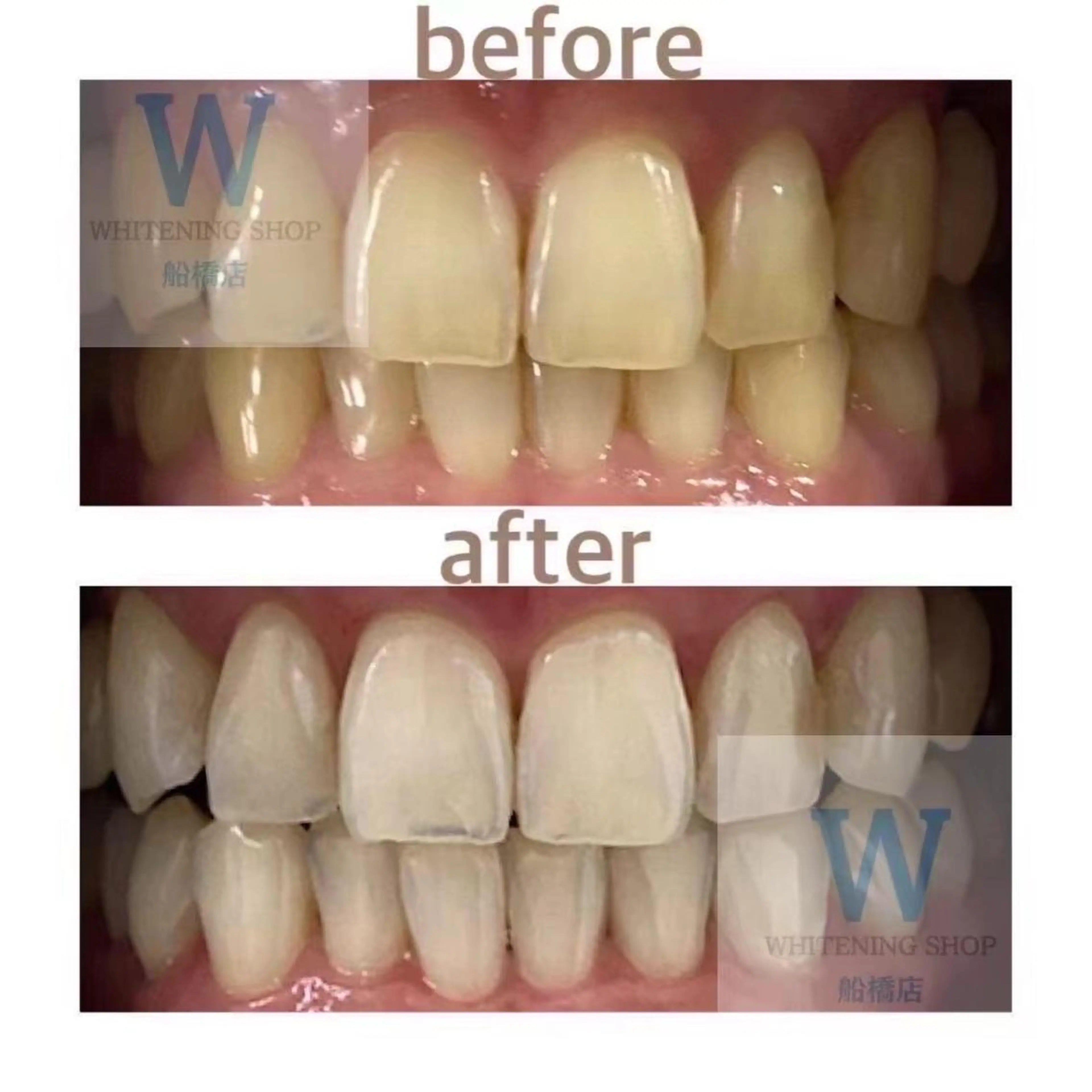 ホワイトニング ショップ船橋店🦷のエステ・リラクイメージ