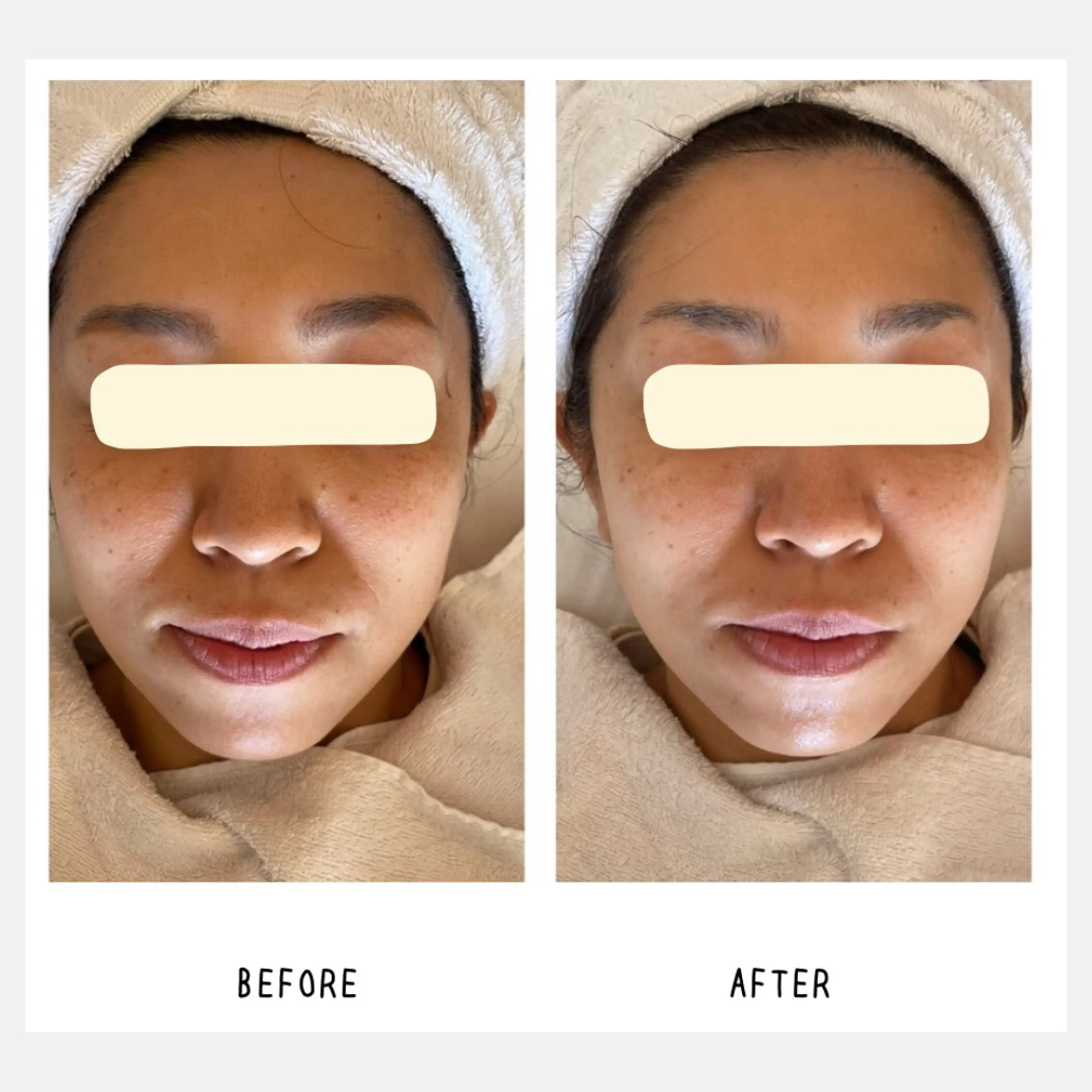 Yoshino Erinaのエステ・リラクイメージ