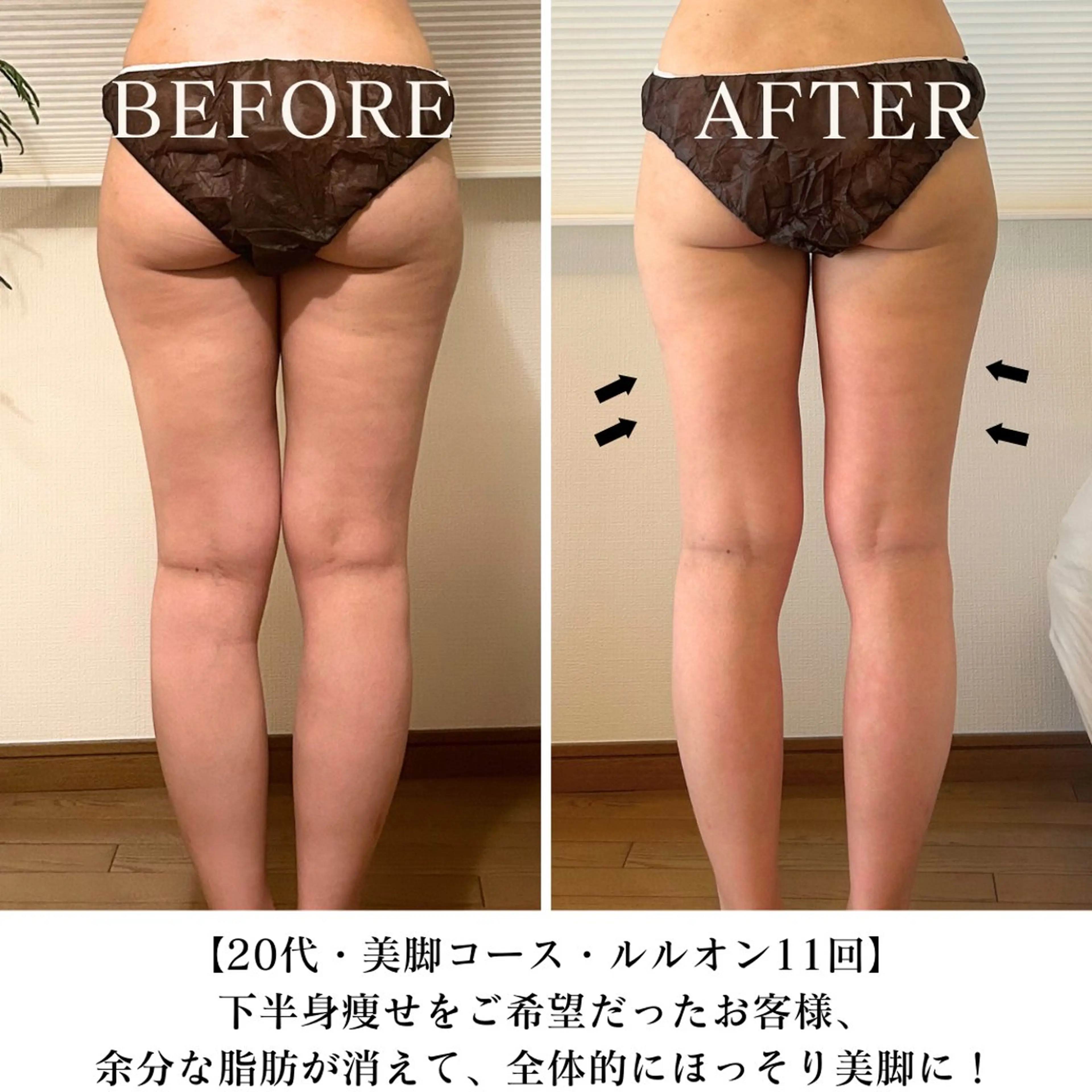 【美脚コース】ヒップ・太もも猛烈アタック  ¥11000→¥6800  100分の写真