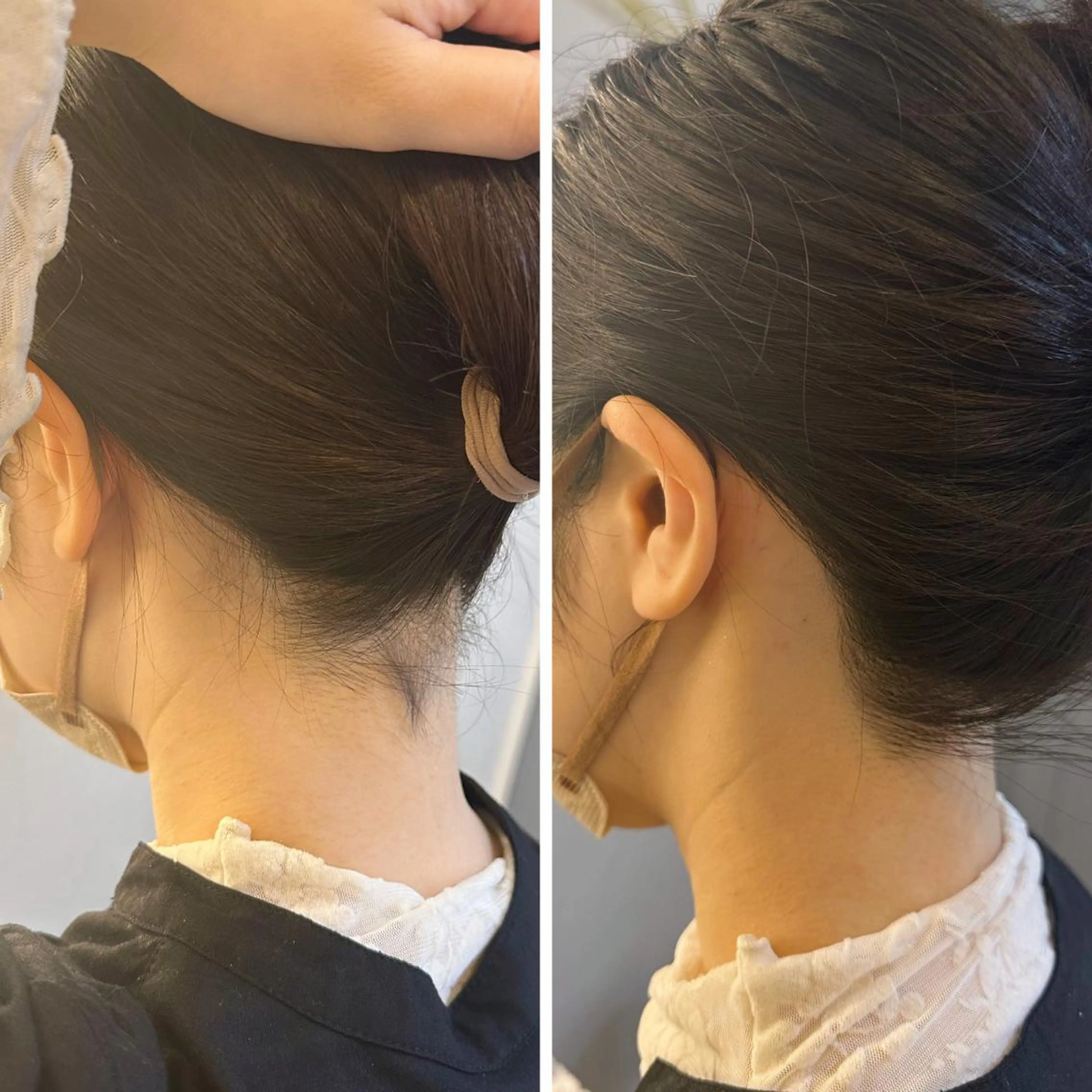 脱毛 うなじ脱毛/美肌脱毛 LABELのエステ・リラクイメージ