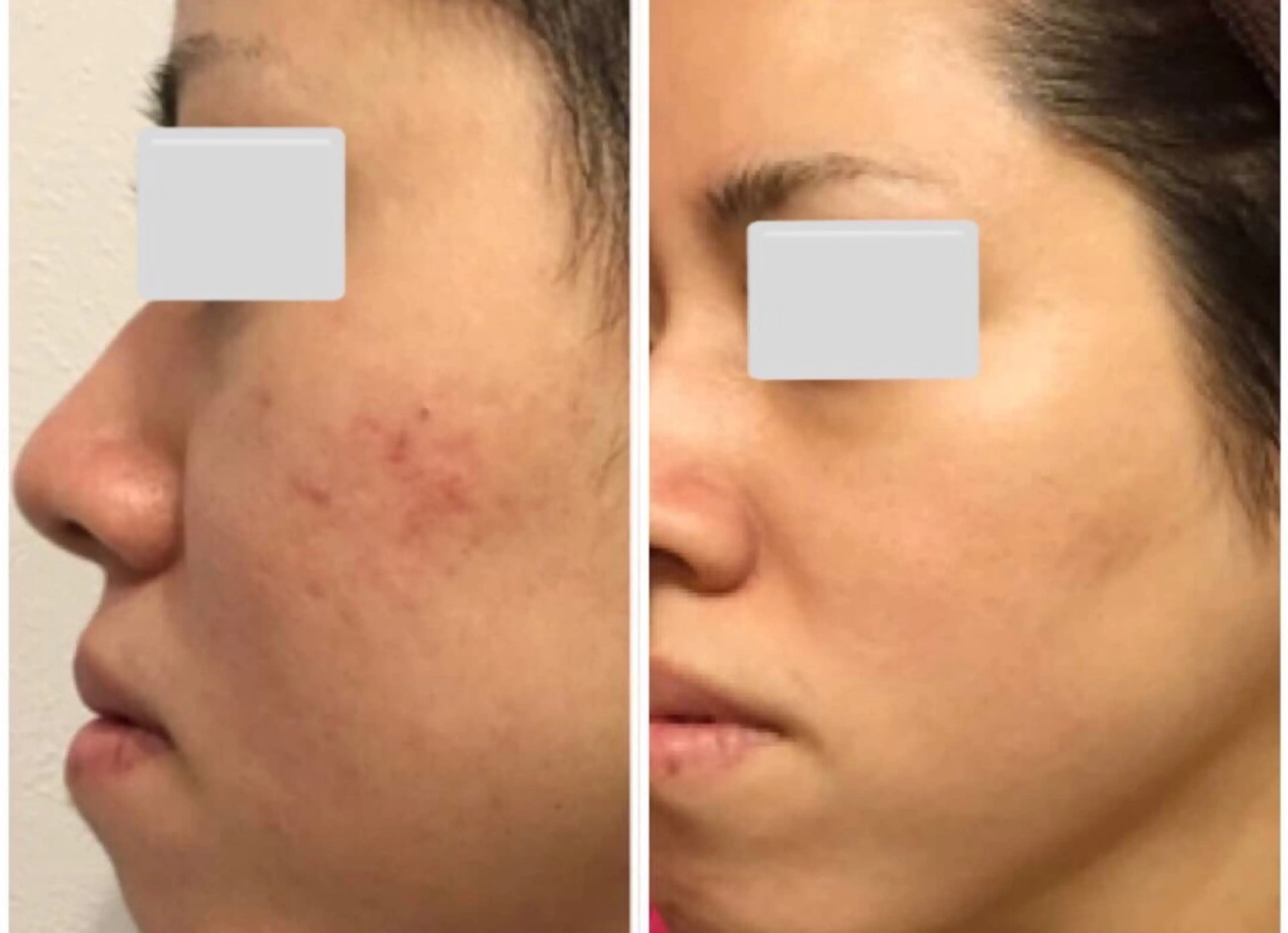 エステ 肌質改善サロン La Divinaのエステ・リラクイメージ