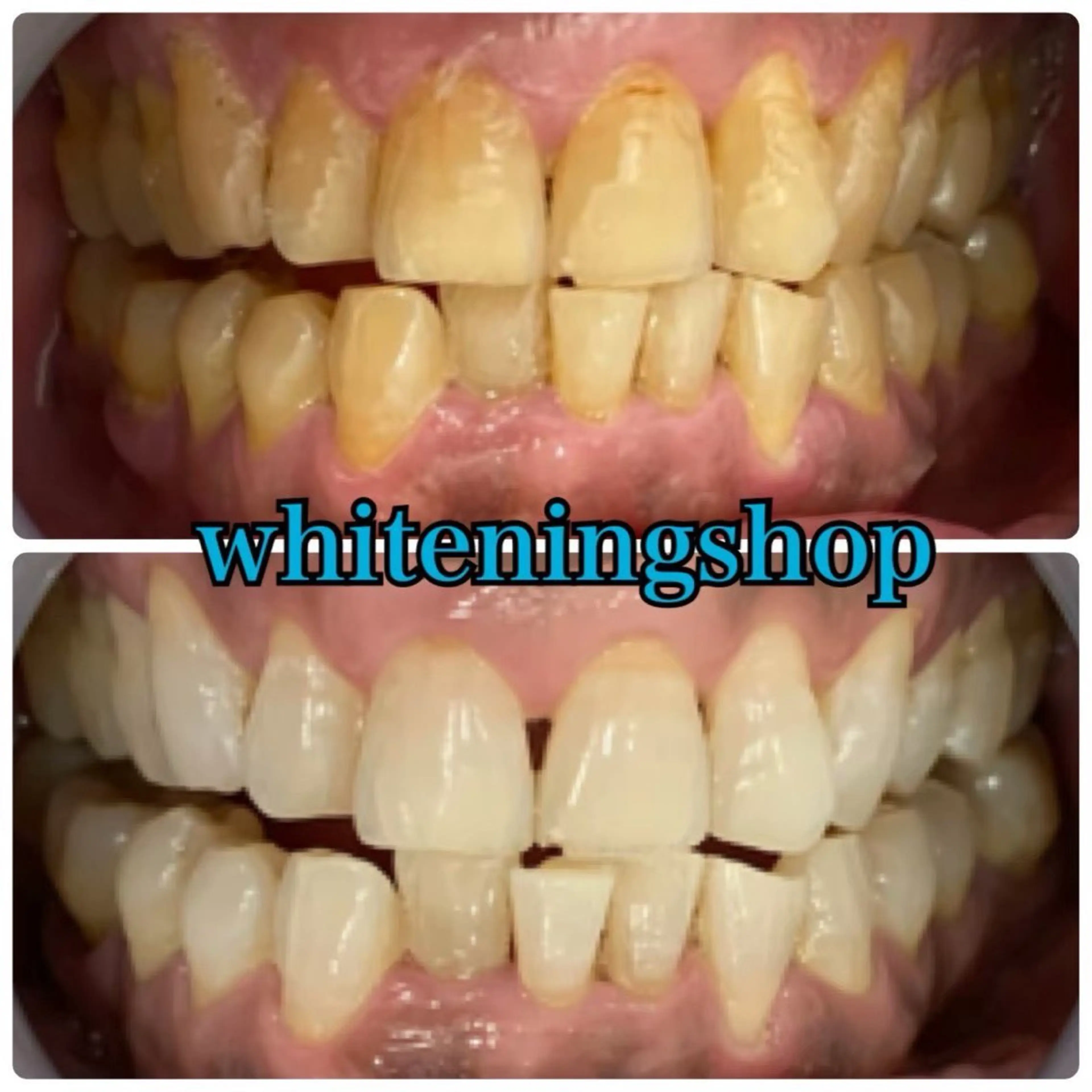 その他 ホワイトニング ショップ津店のその他イメージ