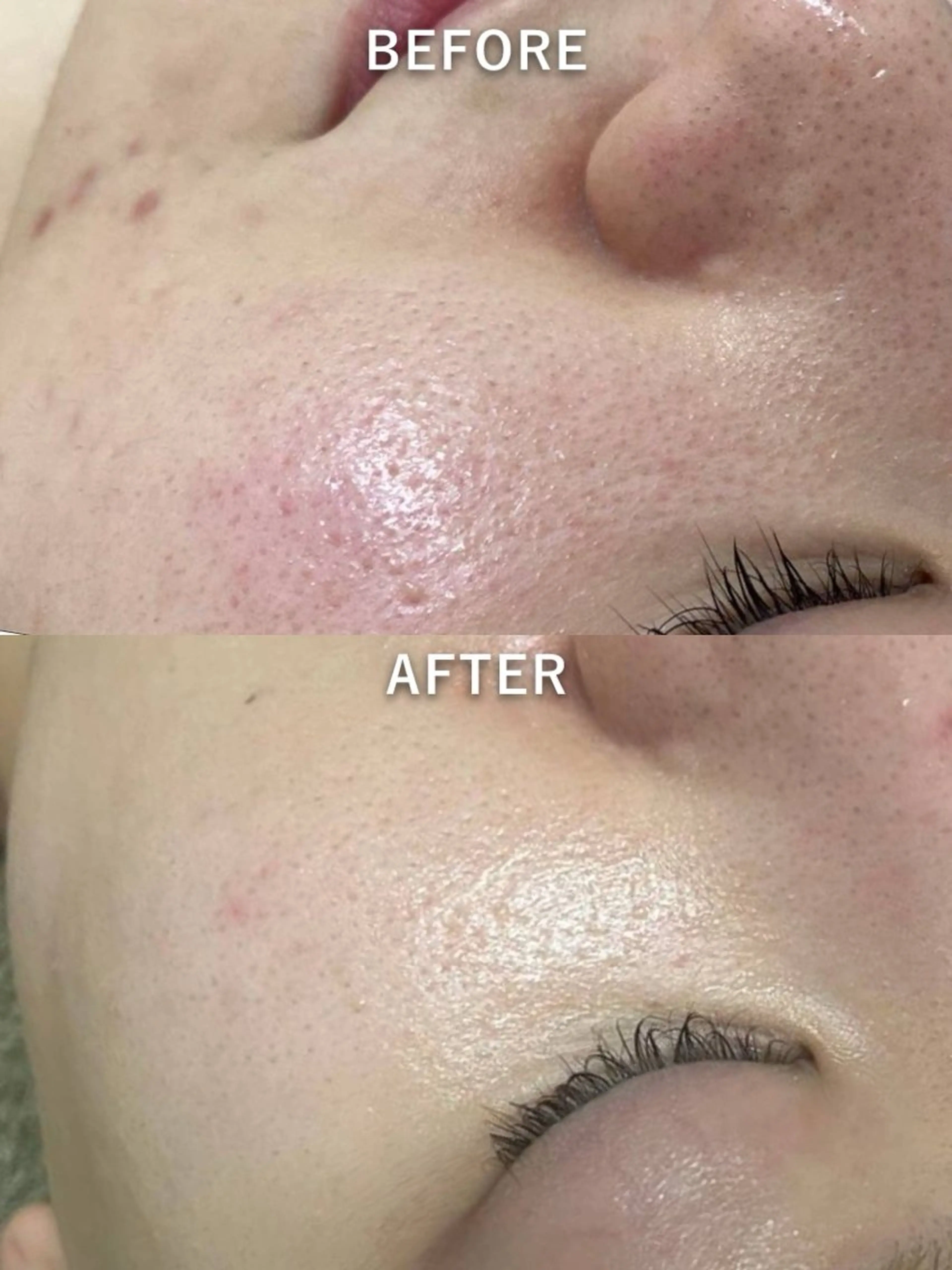 エステ 韓国美肌/肌質改善 【天神】のエステ・リラクイメージ