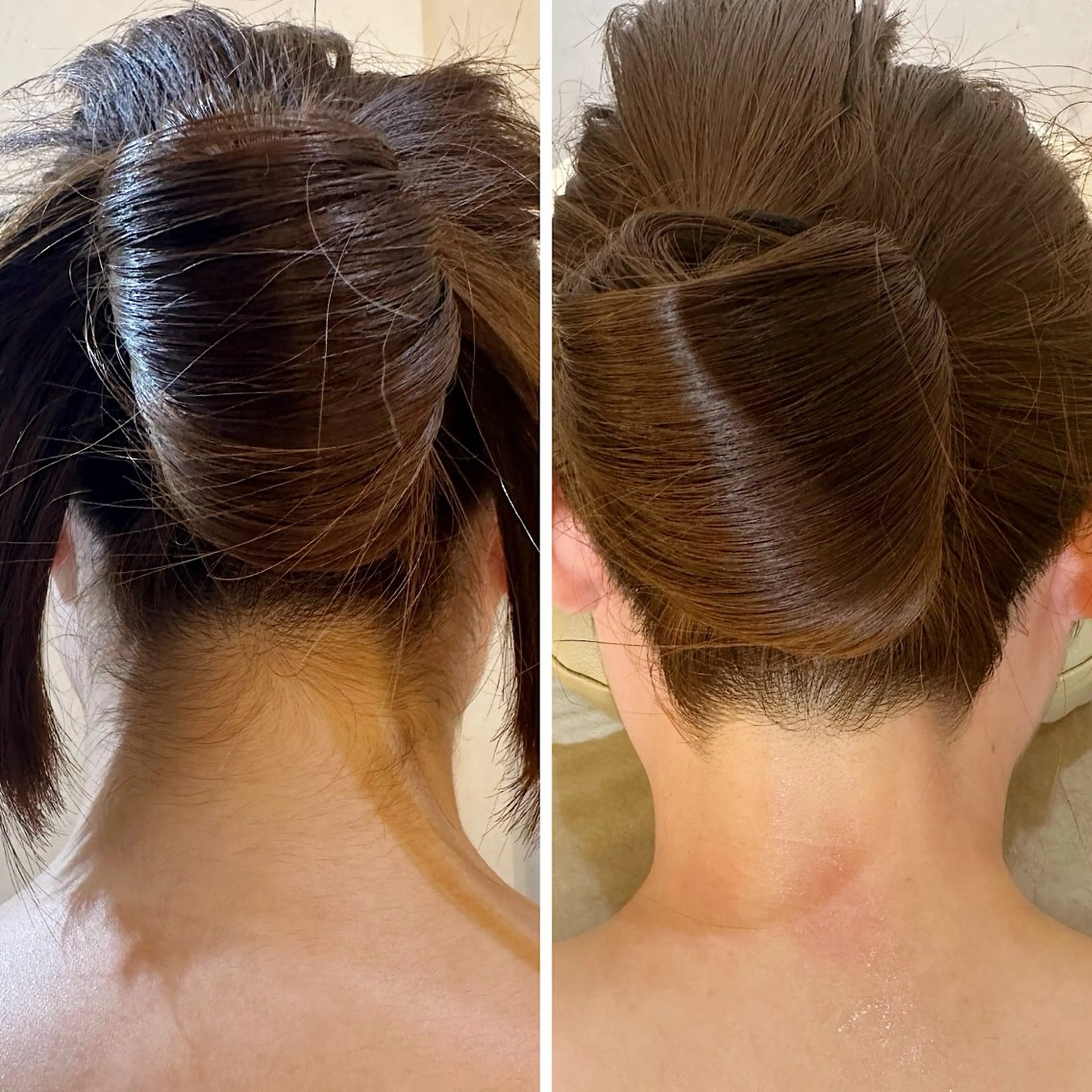 脱毛 うなじ脱毛/美肌脱毛 LABELのエステ・リラクイメージ