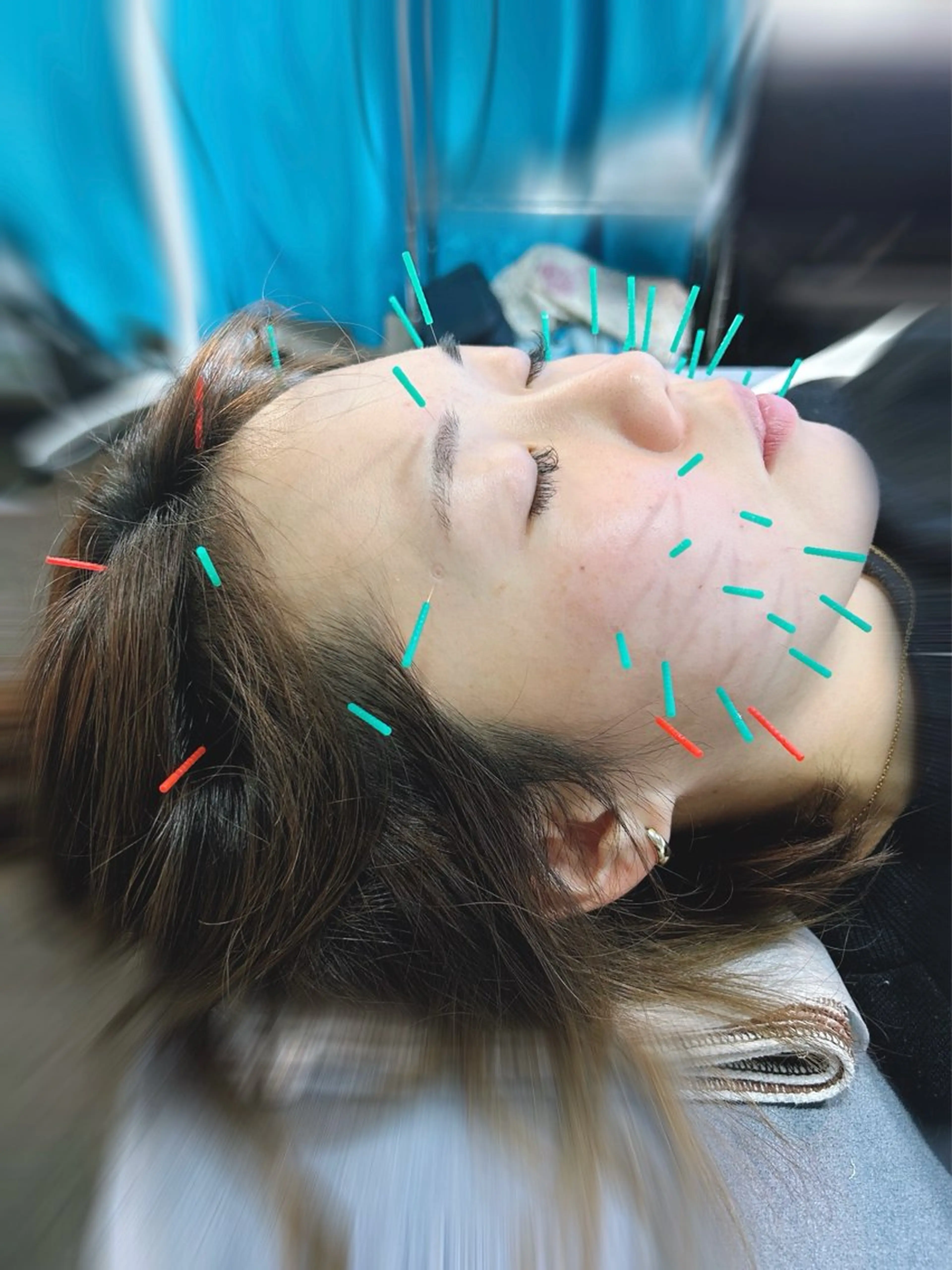 エステ リラク 🌸代々木美容鍼灸 サロン"さくら"🌸のエステ・リラクイメージ