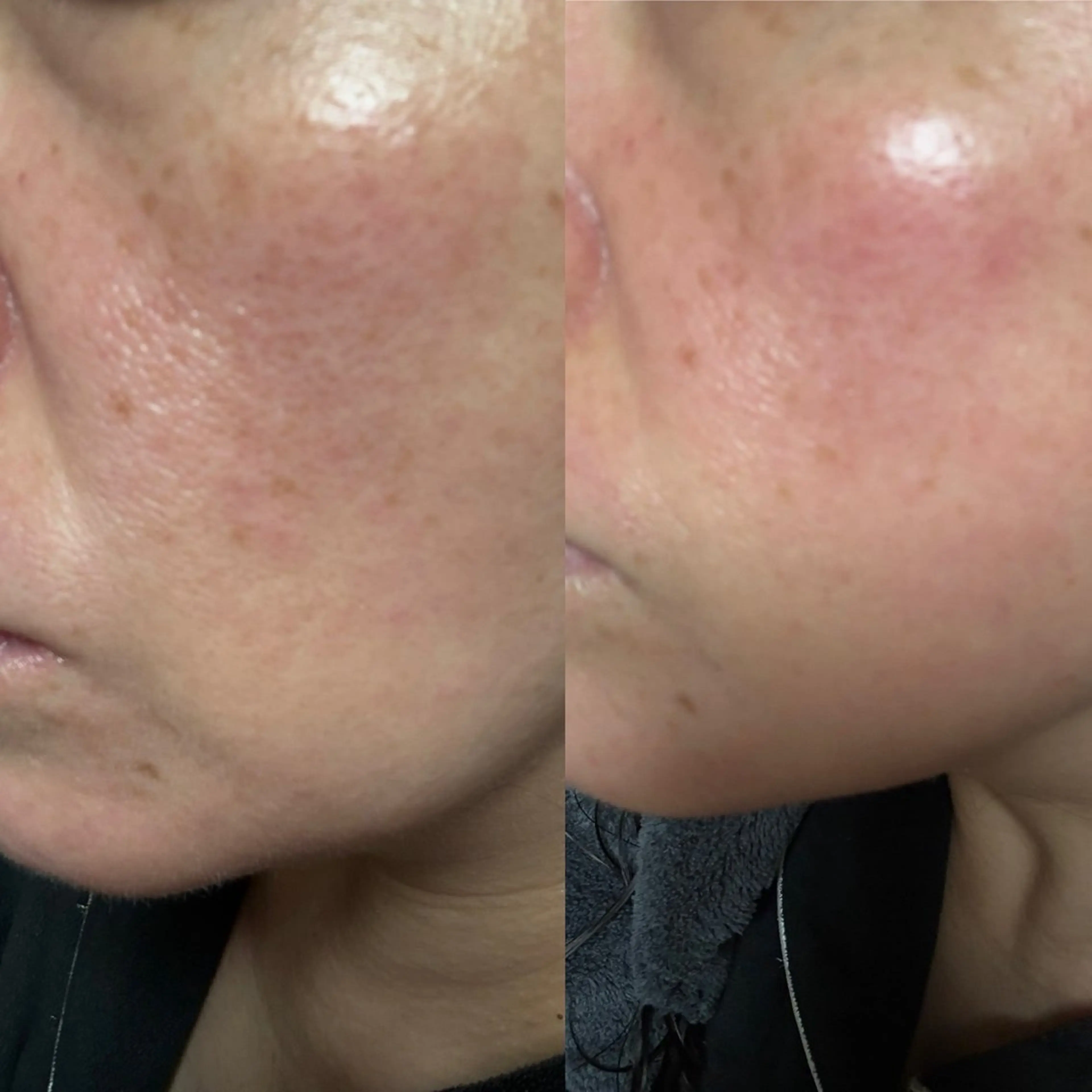 エステ 美と健康サロン Lino leaのエステ・リラクイメージ