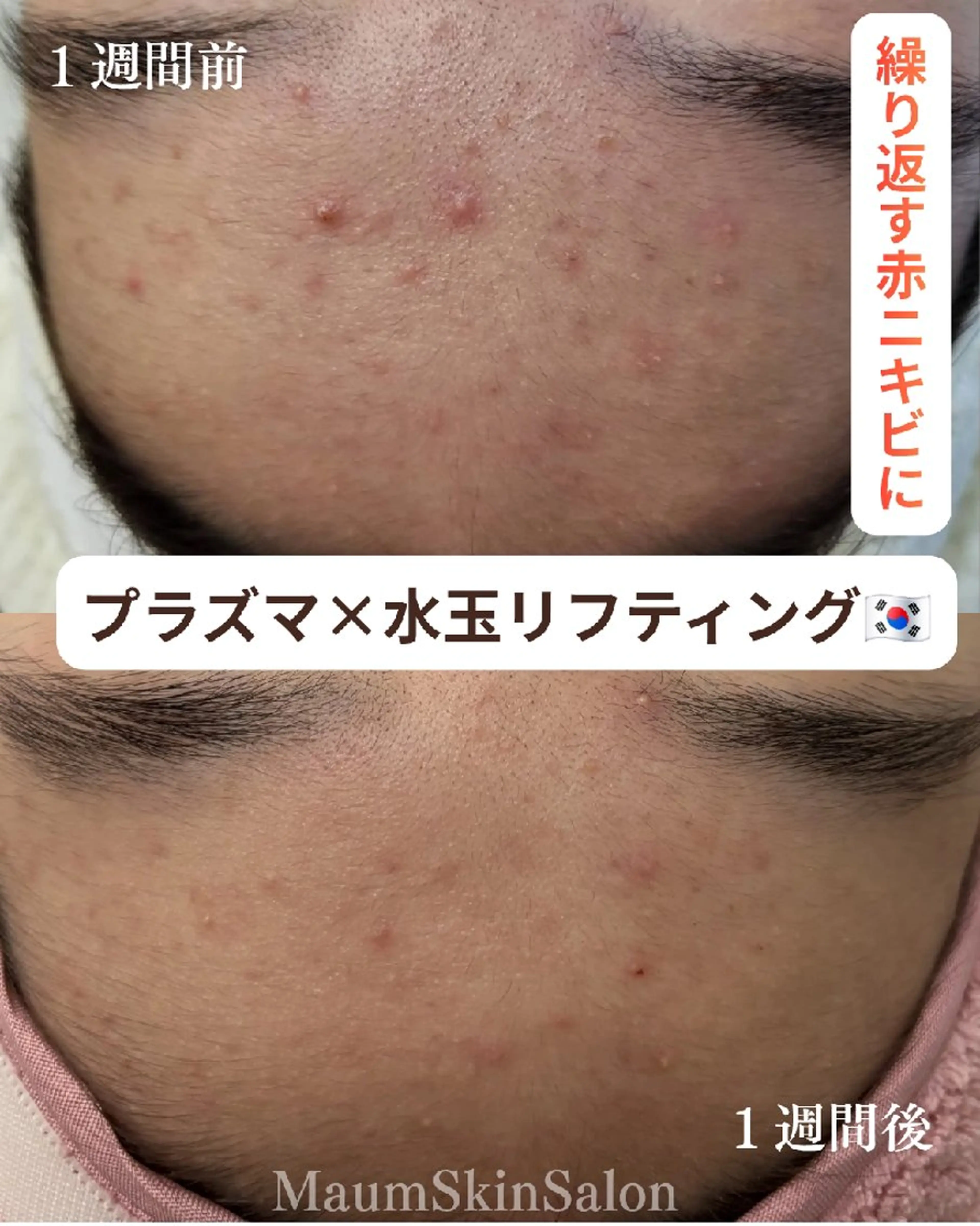 エステ Maum SkinSalonのエステ・リラクイメージ