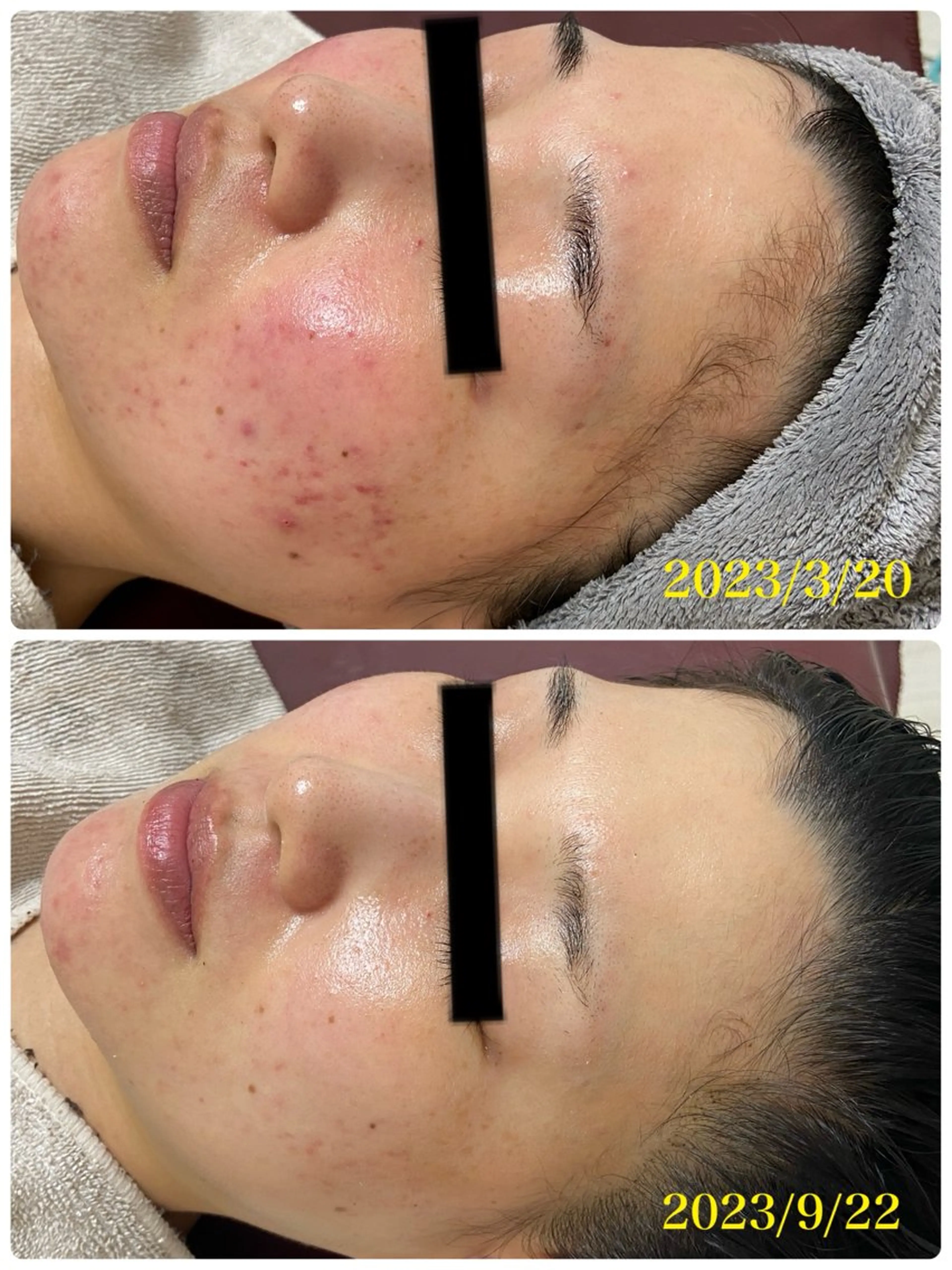 エステ REBORN by ami-goのその他イメージ