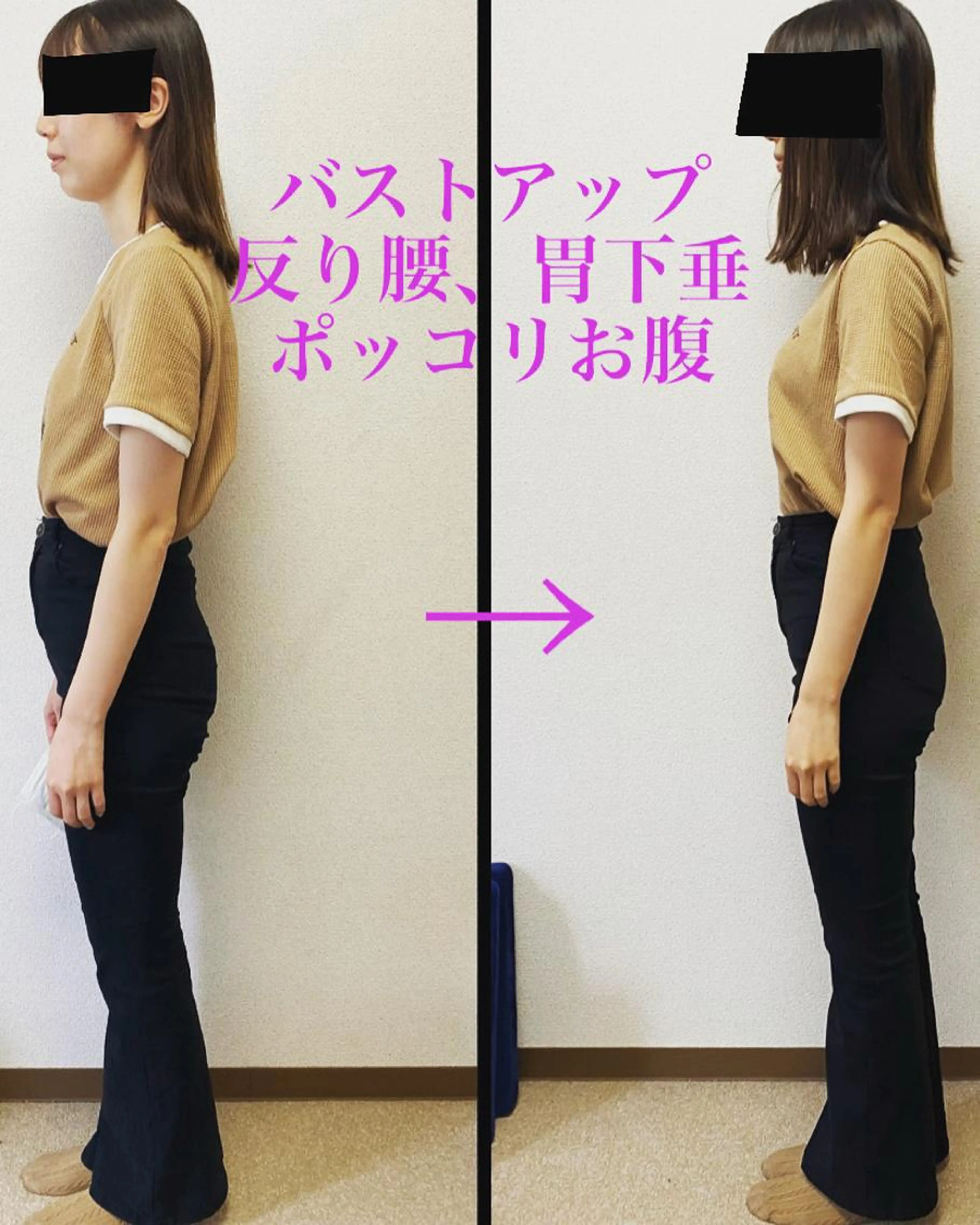 🌸残1名!🌸華奢な20代限定インスタSNSモデル! ■猫背/巻き肩/腹圧型ポッコリお腹/肩こり※編集で眼は消しますの写真