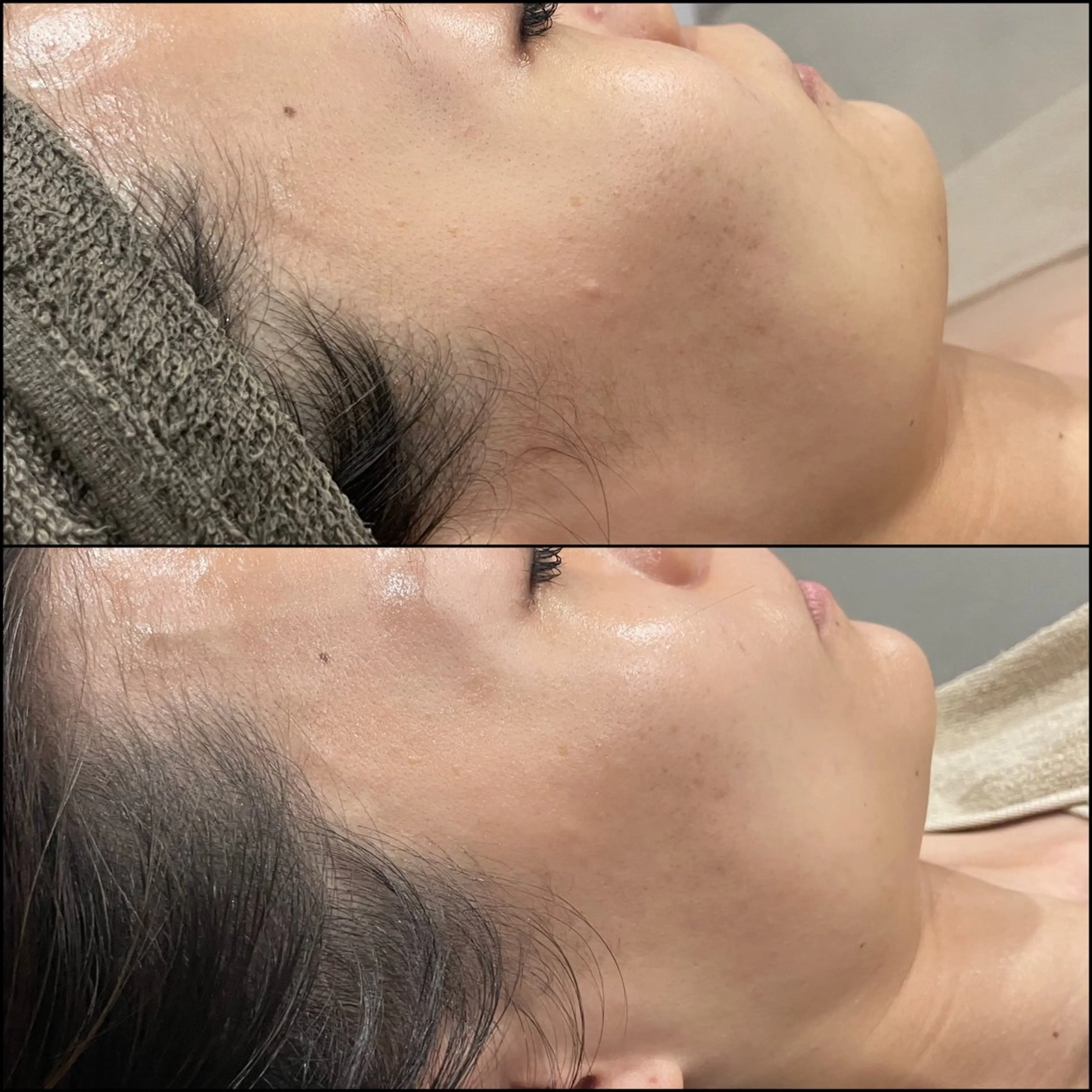 エステ LiZA エステティックサロンのエステ・リラクイメージ