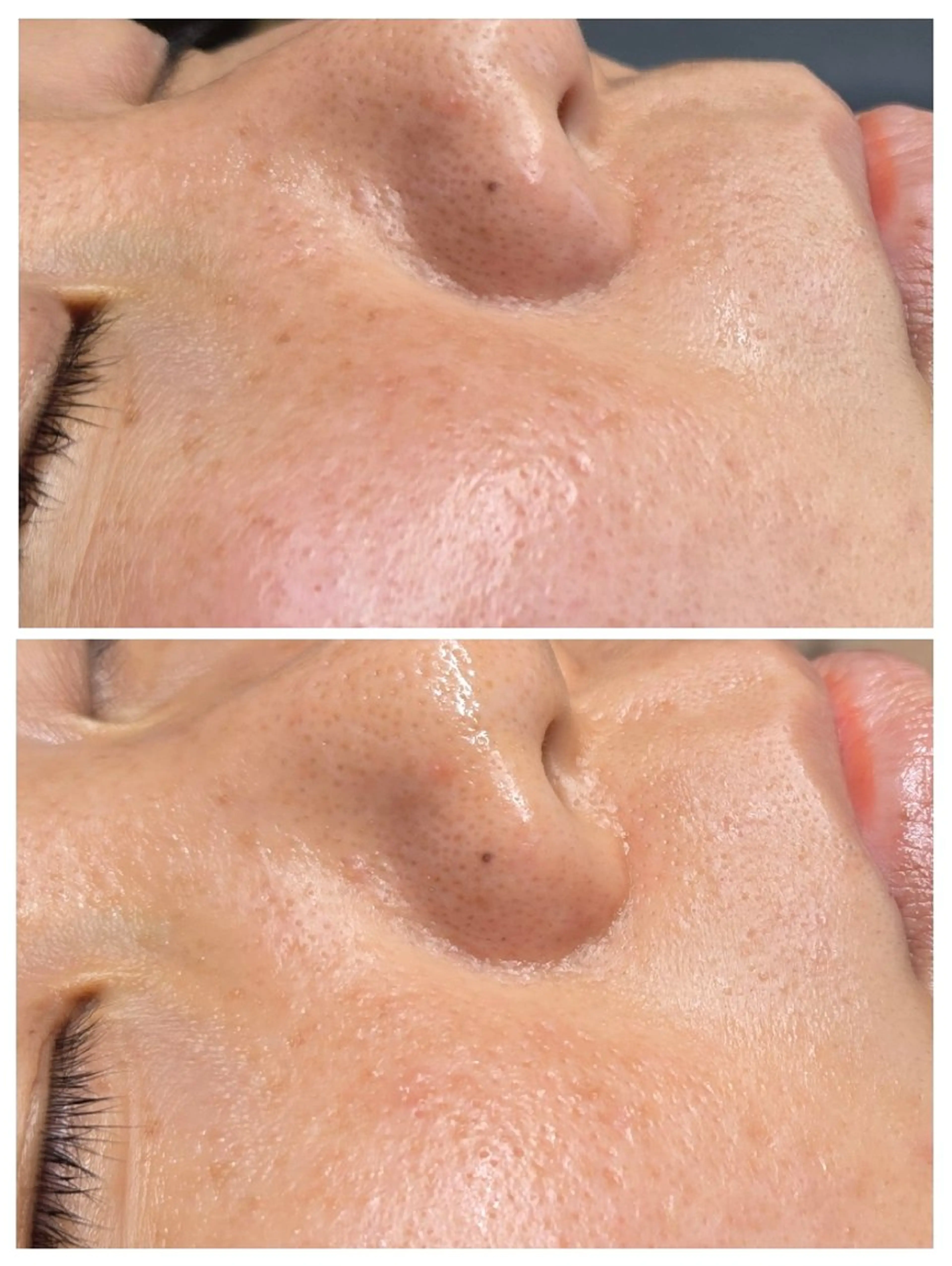 フェイシャルワックス GLOW所属・渡邊 真依のエステ・リラクイメージ