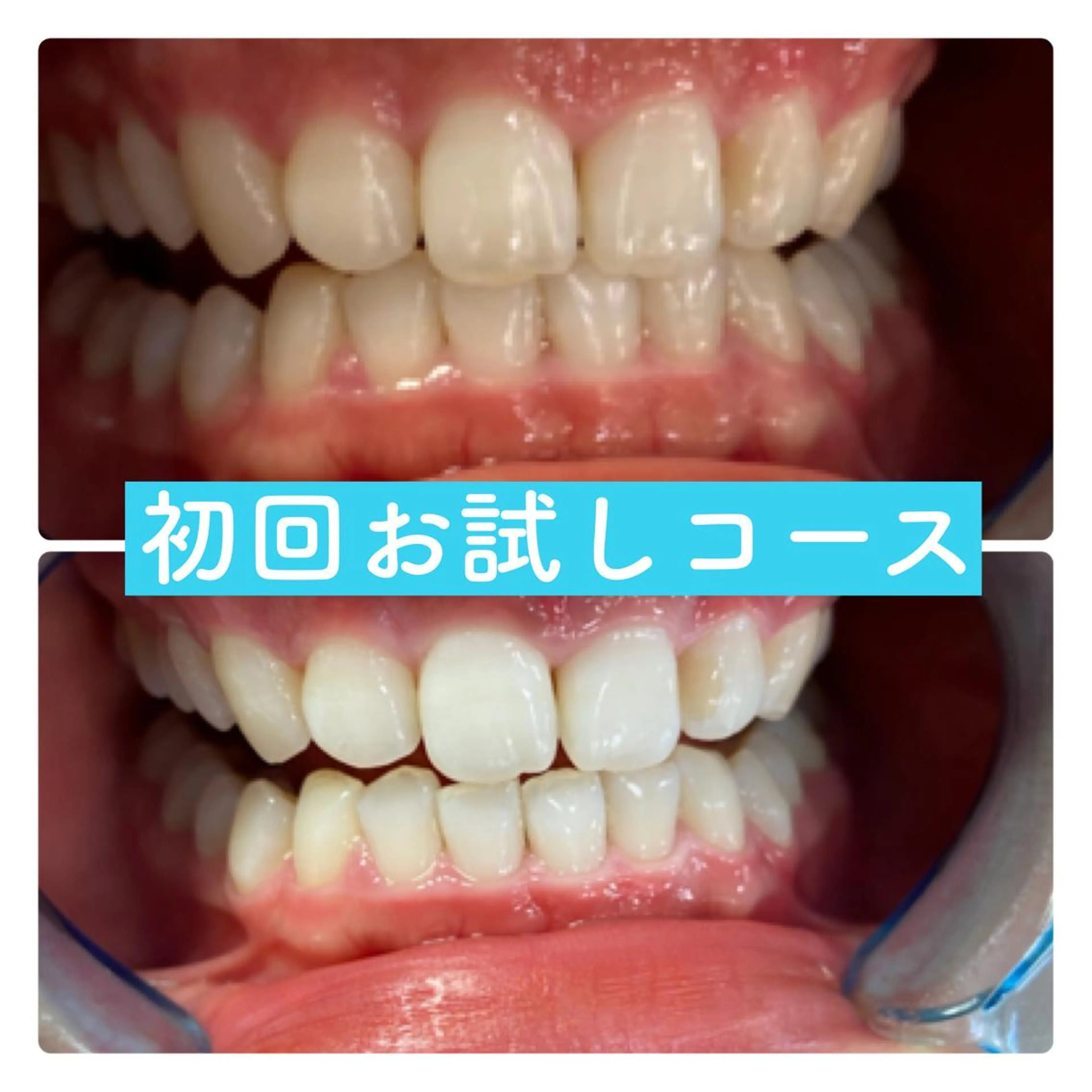 ホワイトニングルーム 横浜店のその他イメージ